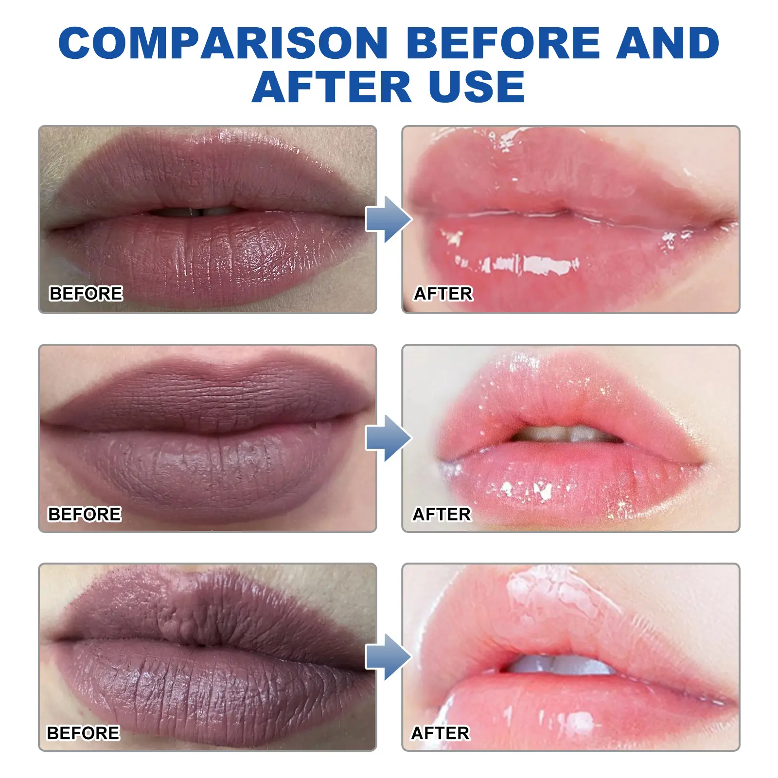 Moisturizing Lip Balm for Dry & Chapped Lips - West 9 moisturizing lip balm whiten lines moisturize West Month 361 5708