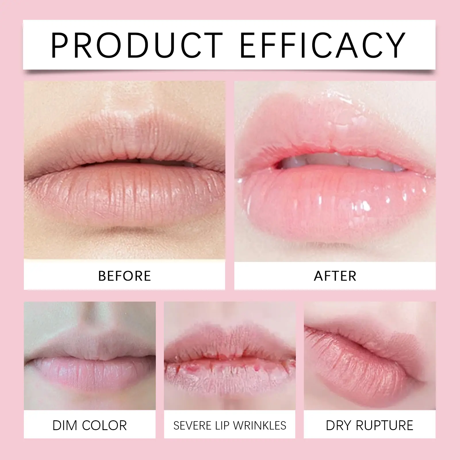 Moisturizing Lip Mask Gel for Deep Hydration - West&Month 9 moisturizing lip mask reduce lines protective West Month 542 8269