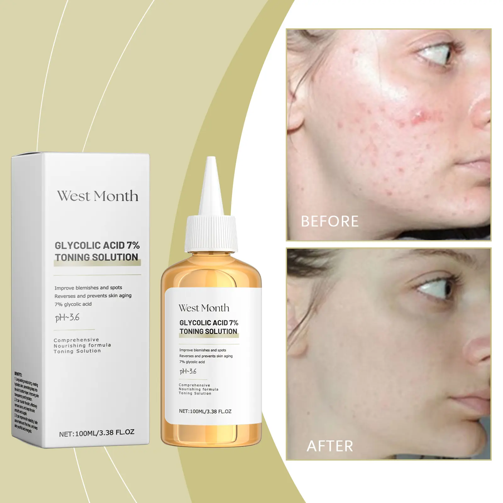 Moisturizing Toner for Acne-Prone Skin - Hydrating & Soothing - West&Month 2 moisturizing toner gently clean acne hydrate West Month 455 7003