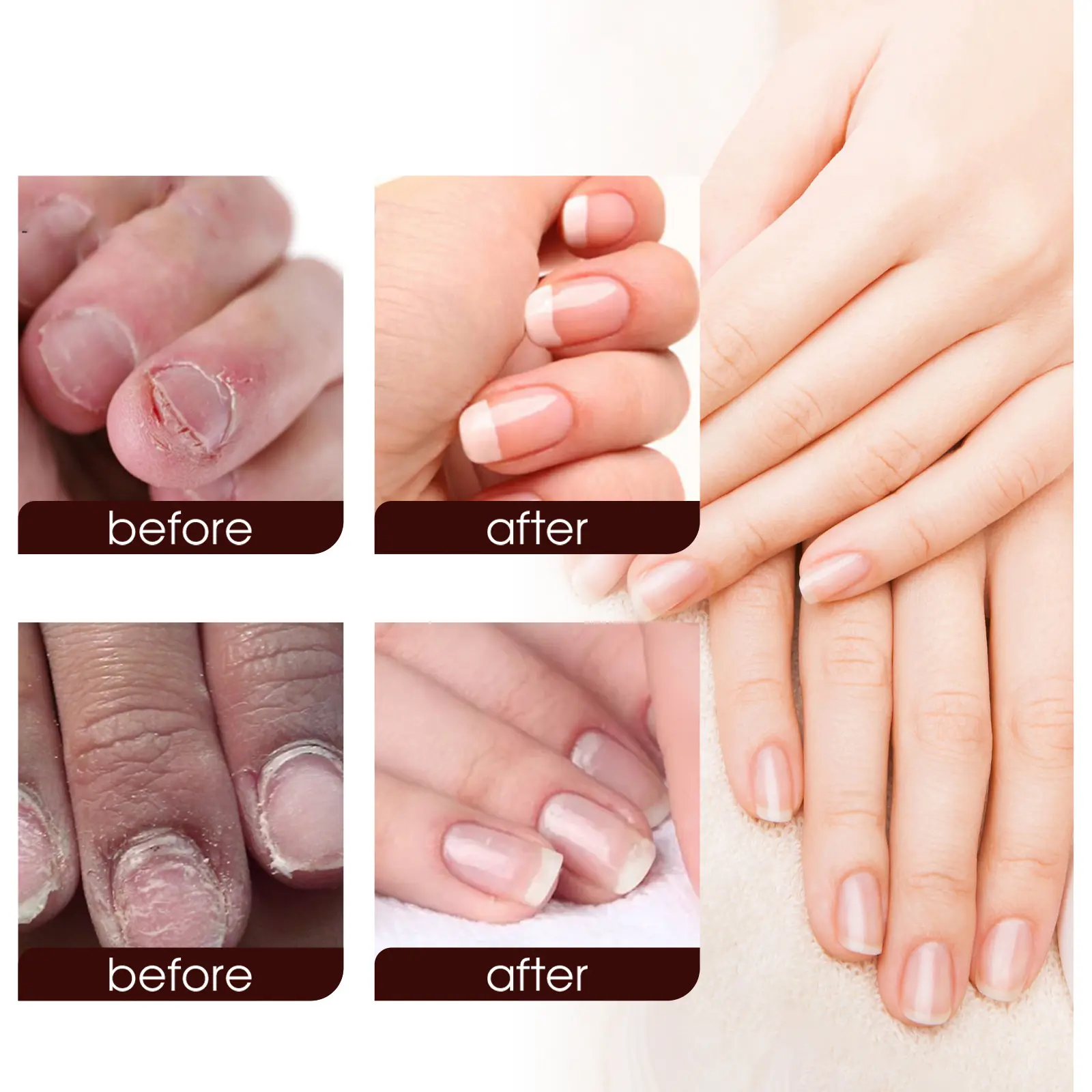 Nail Care Cream for Gentle Shine and Moisture - West Month - West 8 nail care cream clean soft shine nails West Month 419 6511