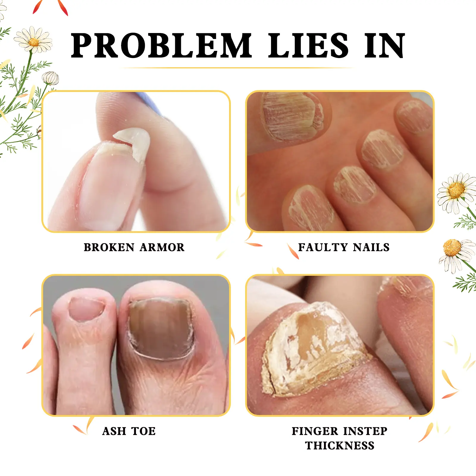 Nail Care Essence for Damaged & Discolored Nails - West&Month 8 nail care essence clean soft bright nails West Month 355 5622