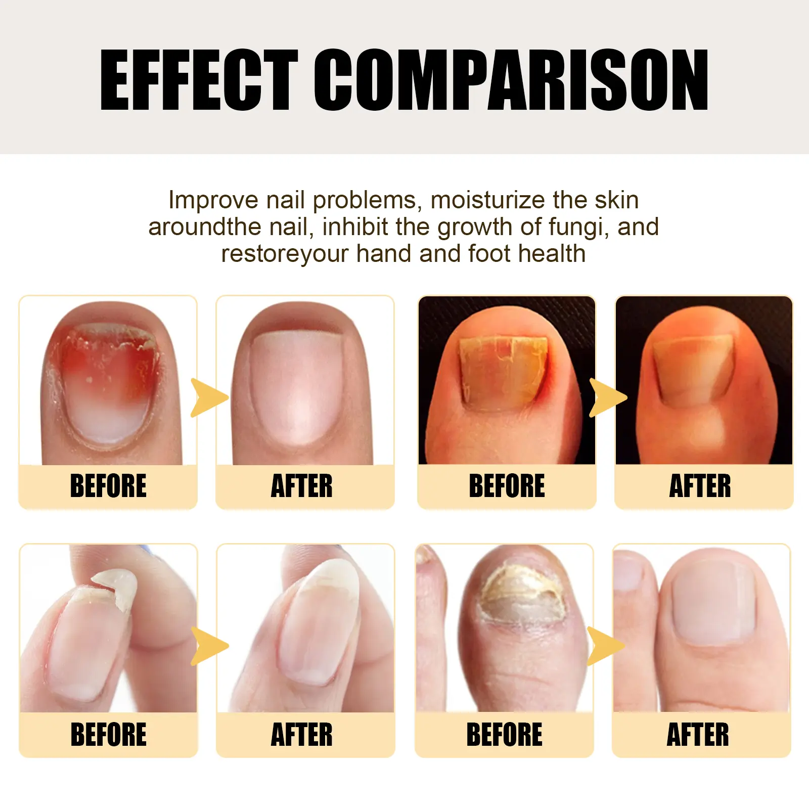 Nail Care Essence for Damaged & Discolored Nails - West&Month 9 nail care essence clean soft bright nails West Month 355 5623