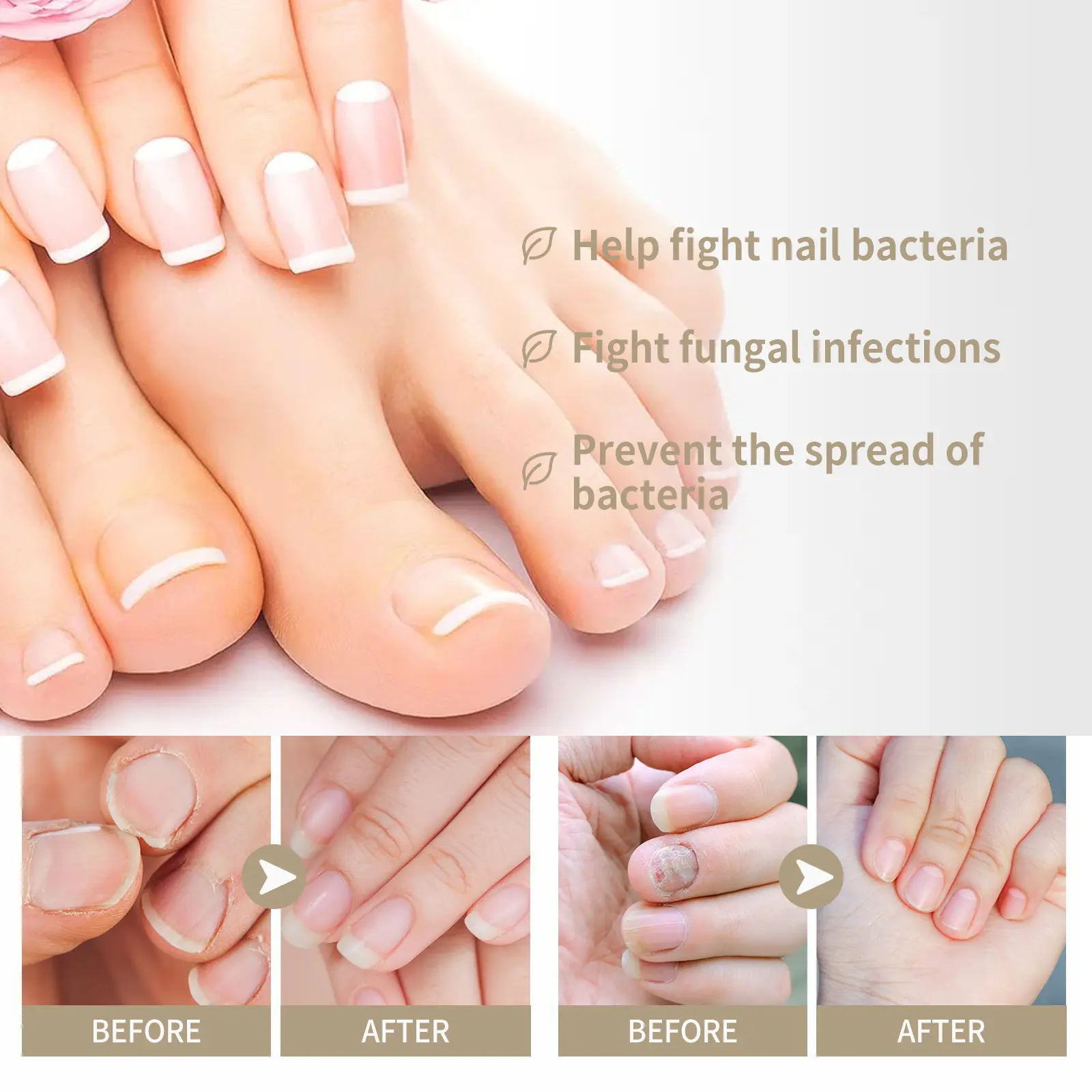West&Month Nail Care Essence for Nourishing and Strengthening Nails 4 nail care essence gently pamper nails West Month 374 5885