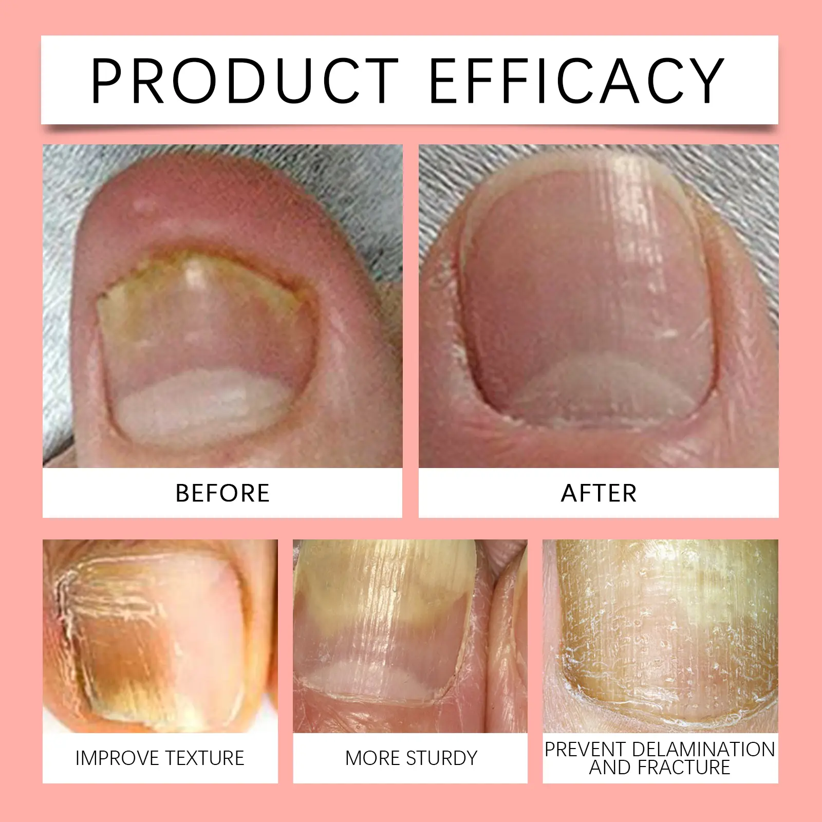 Nail Care Essence Moisturizing & Strengthening Treatment - West&Month 9 nail care essence moisturize cure fingernails West Month 477 7323