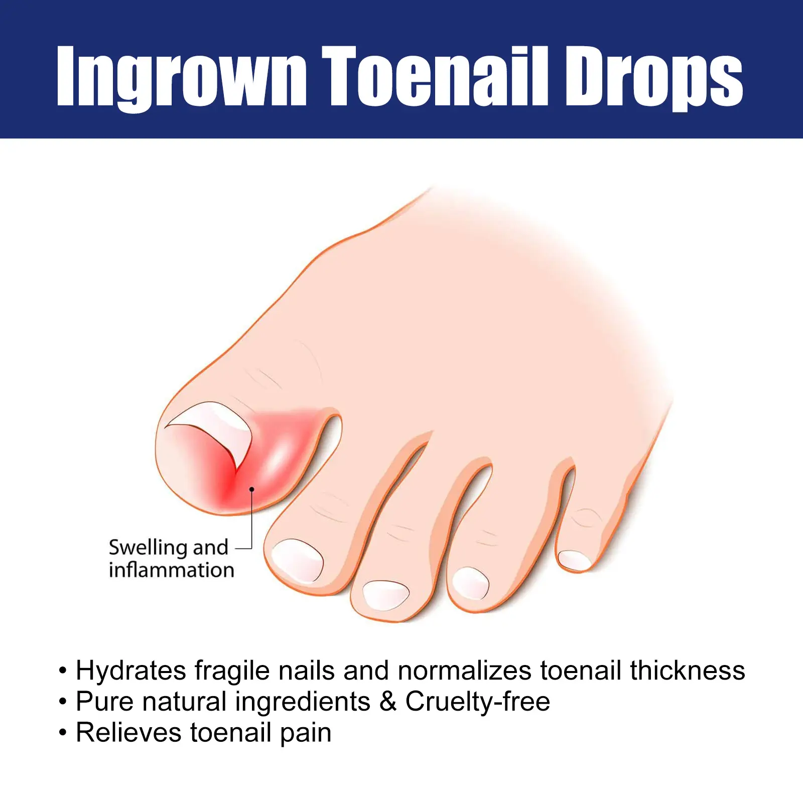 Nail Care Solution for Ingrown Nail Repair and Strength - West&Month 4 nail care solution clean moisturize strong West Month 177 3321