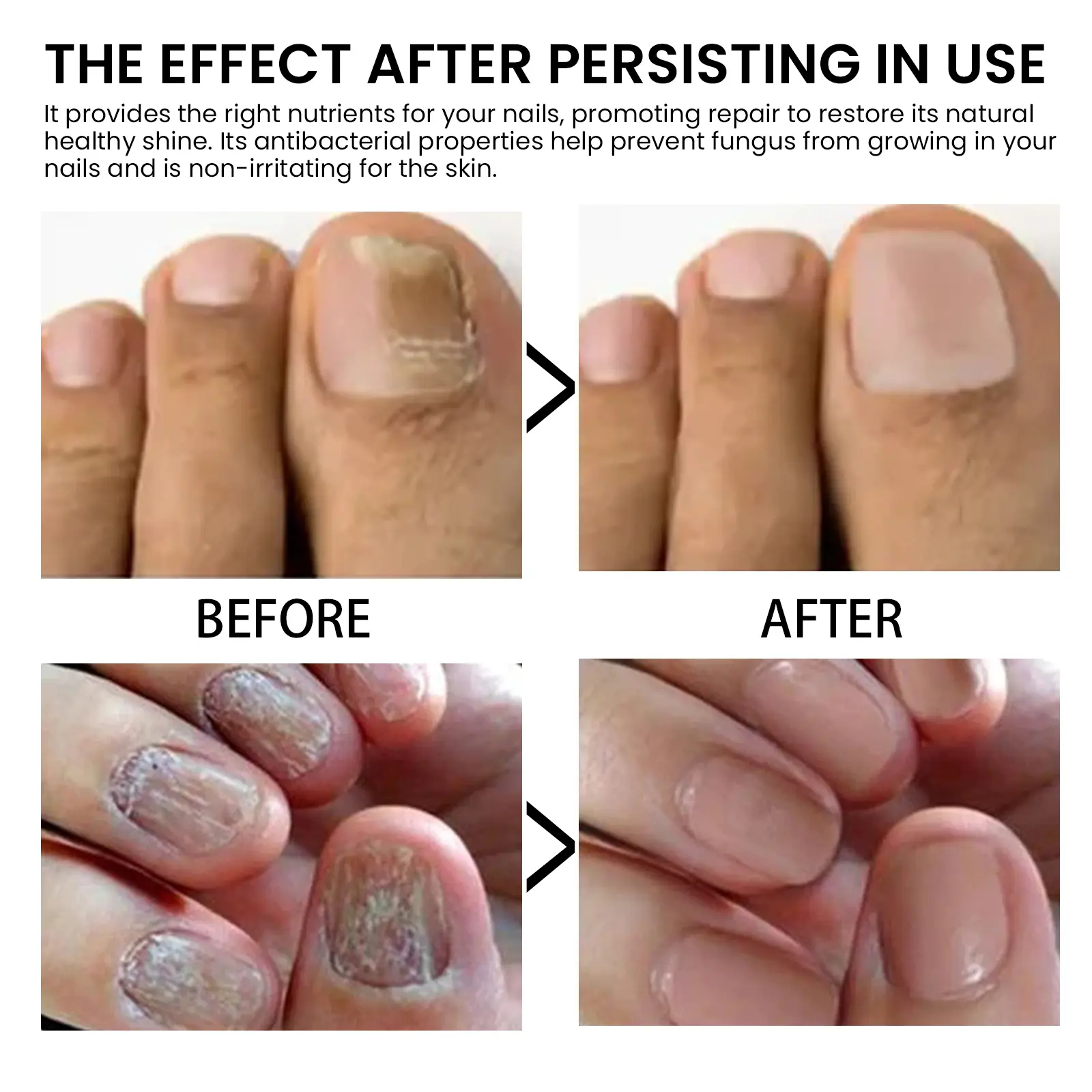 West&Month Nail Cuticle Oil for Moisturizing and Nourishing 8 nail cuticle oil repair soft thicken brighten West Month 356 5637