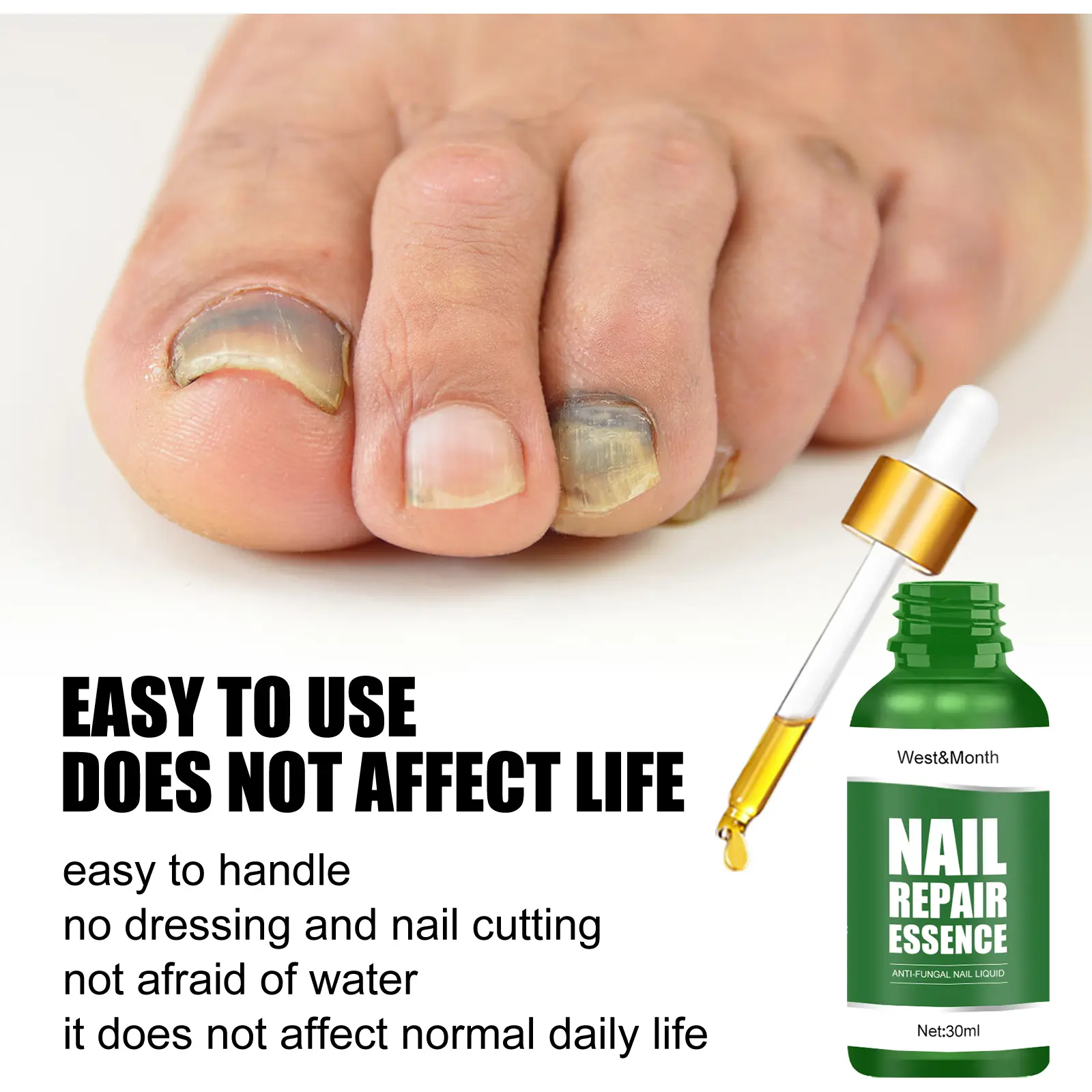 Nail Fungus Treatment Essence for Repair and Recovery - West&Month 3 nail repair essence repair rotten nails West Month 286 4713