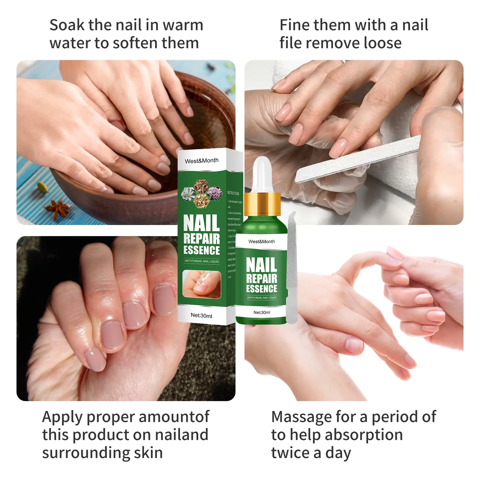 Nail Fungus Treatment Essence for Repair and Recovery - West&Month 5 nail repair essence repair rotten nails West Month 286 4715