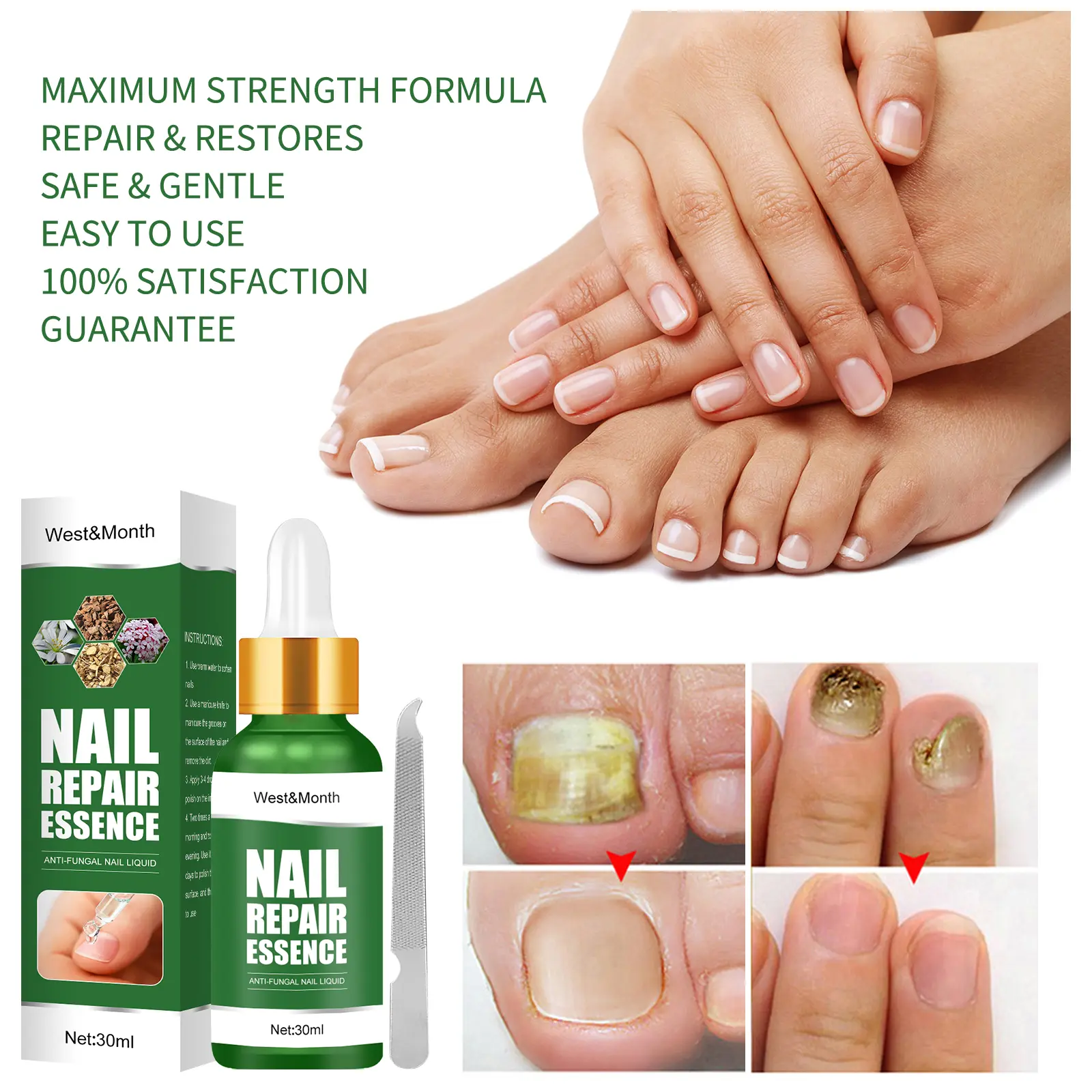 Nail Fungus Treatment Essence for Repair and Recovery - West&Month 6 nail repair essence repair rotten nails West Month 286 4716
