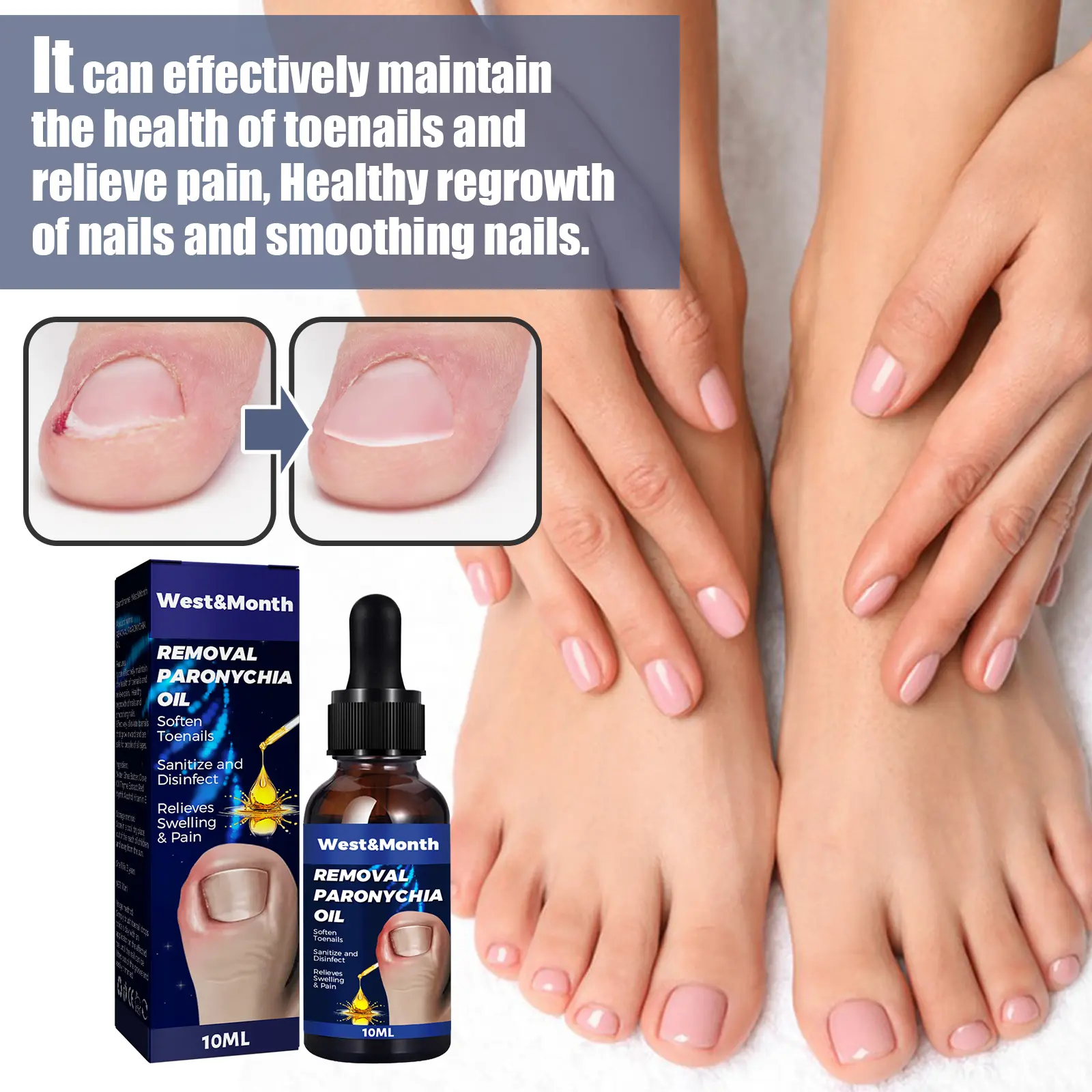 Nail Repair Oil for Moisturizing Care and Growth - West&Month 5 nail repair oil hand foot daily moisturizing West Month 030 1488