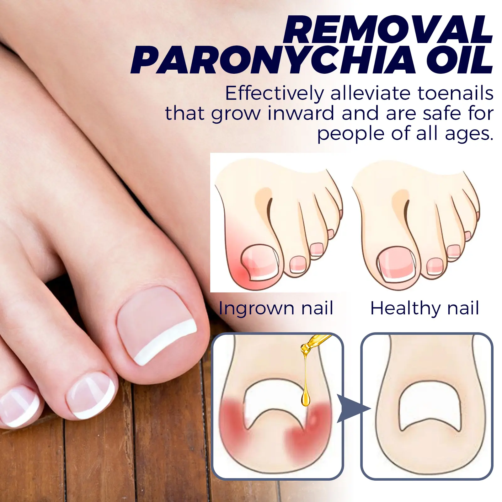 Nail Repair Oil for Moisturizing Care and Growth - West&Month 8 nail repair oil hand foot daily moisturizing West Month 030 1491