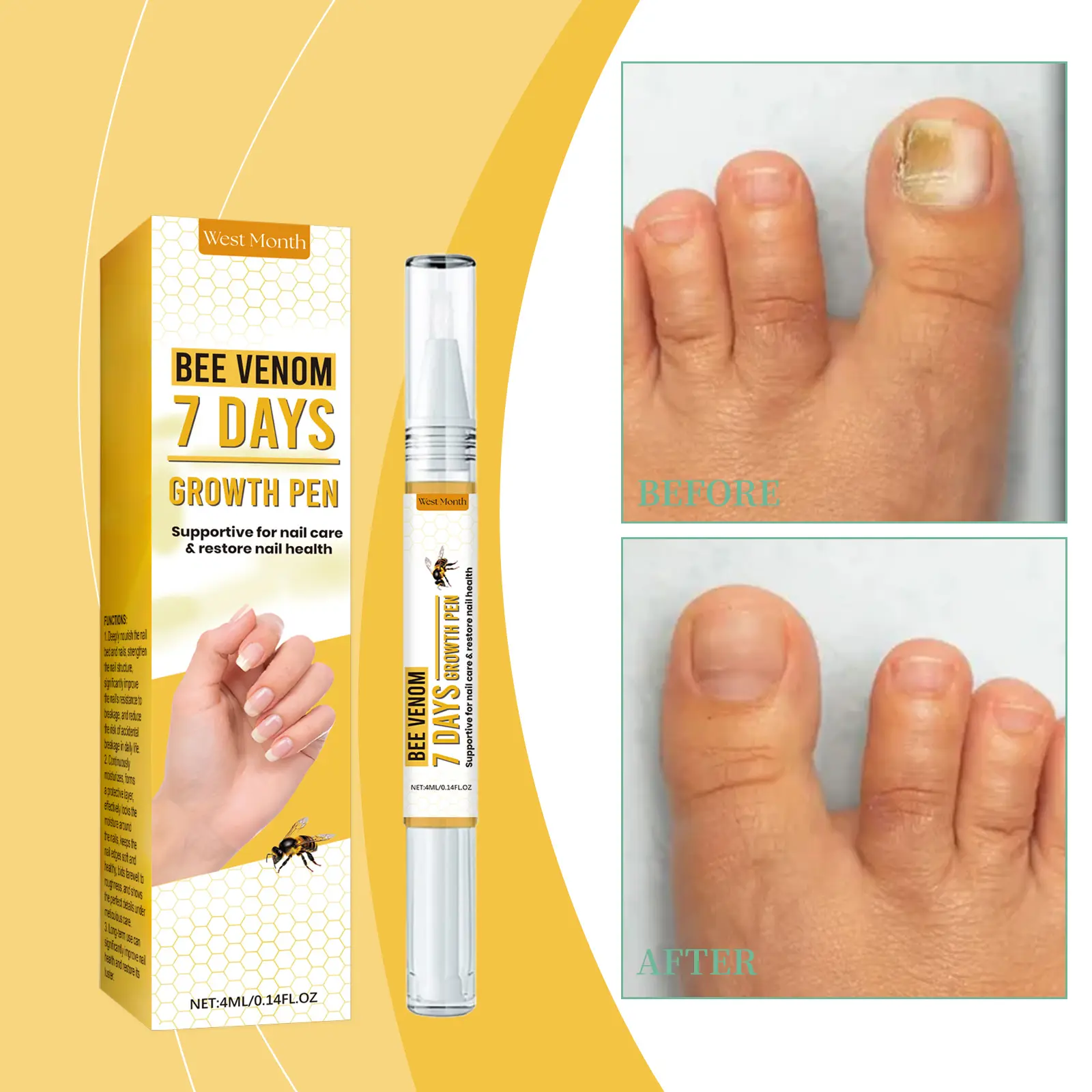 Nail Repair Solution for Strengthening and Moisturizing - West&Month 2 nail repair solution clean gentle moisturize West Month 466 7157