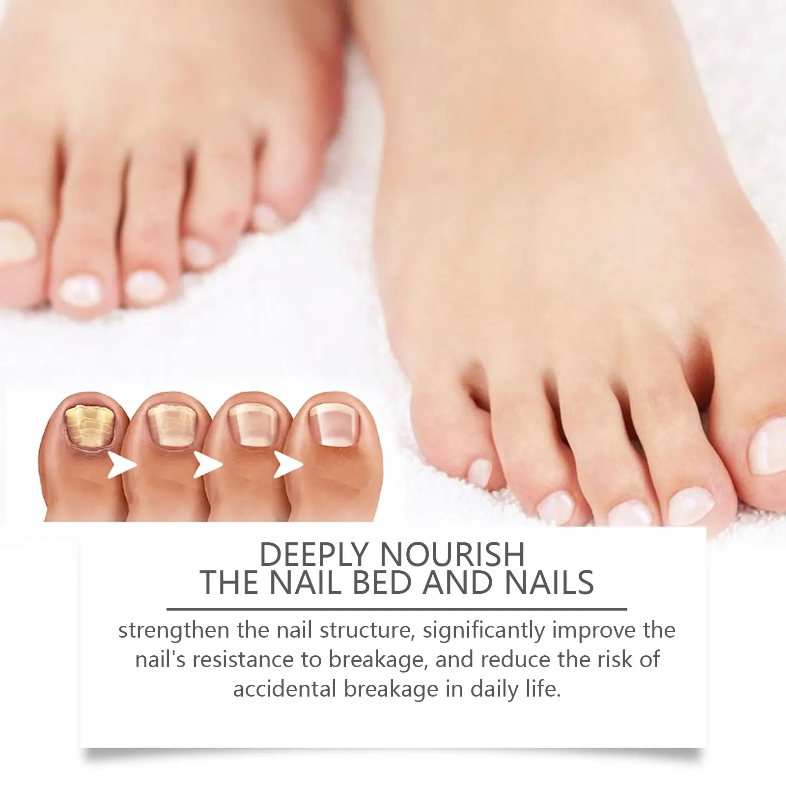 Nail Repair Solution for Strengthening and Moisturizing - West&Month 6 nail repair solution clean gentle moisturize West Month 466 7160