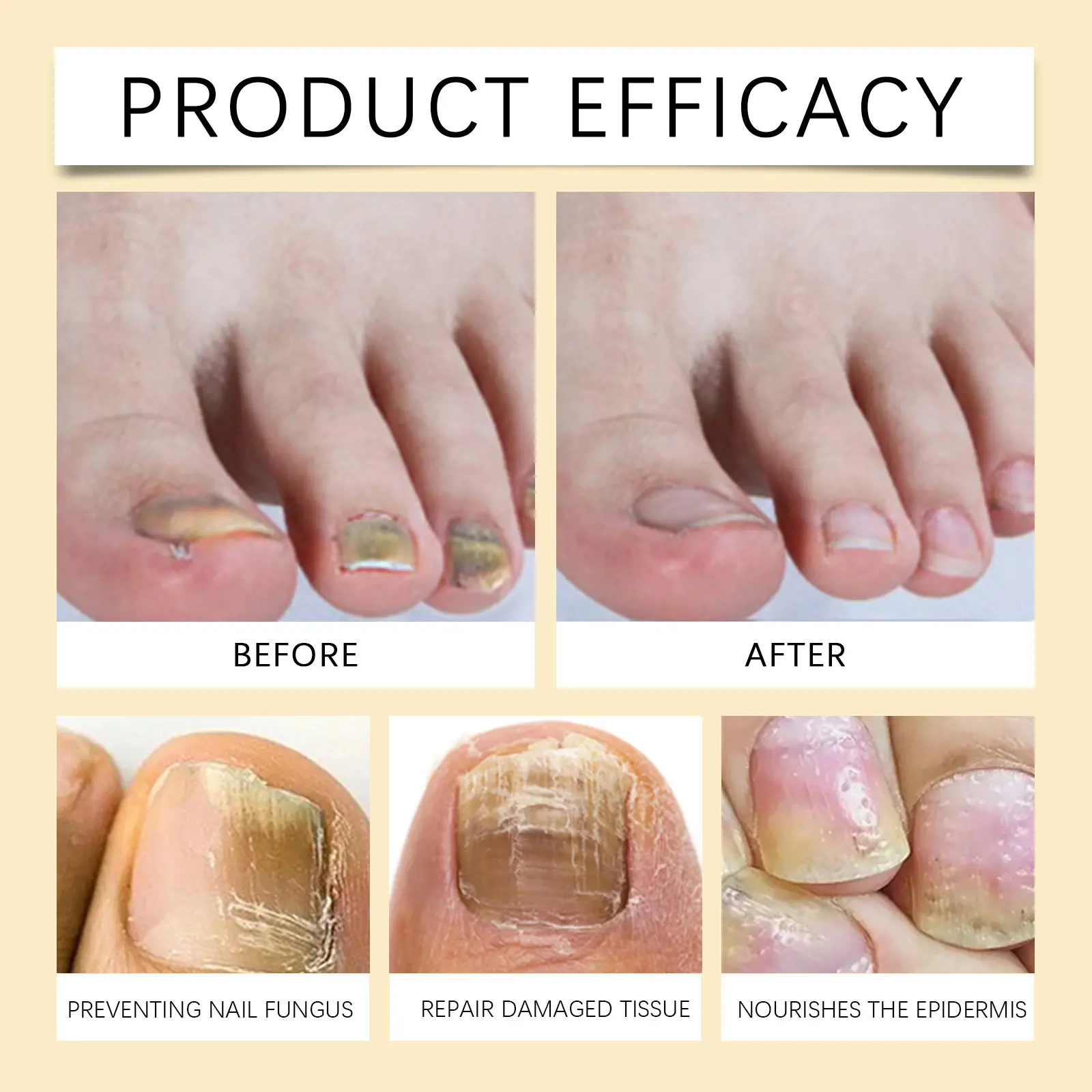 Nail Repair Solution for Strengthening and Moisturizing - West&Month 9 nail repair solution clean gentle moisturize West Month 466 7163