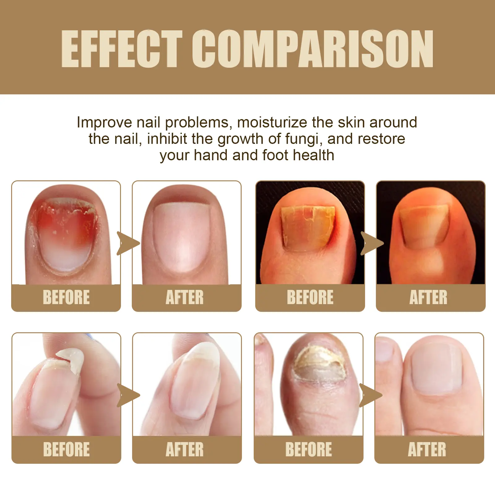 Nails Repair Oil Pen for Damaged Nails Care - West&Month 8 nails repair oil pen clean soft thicken West Month 379 5954
