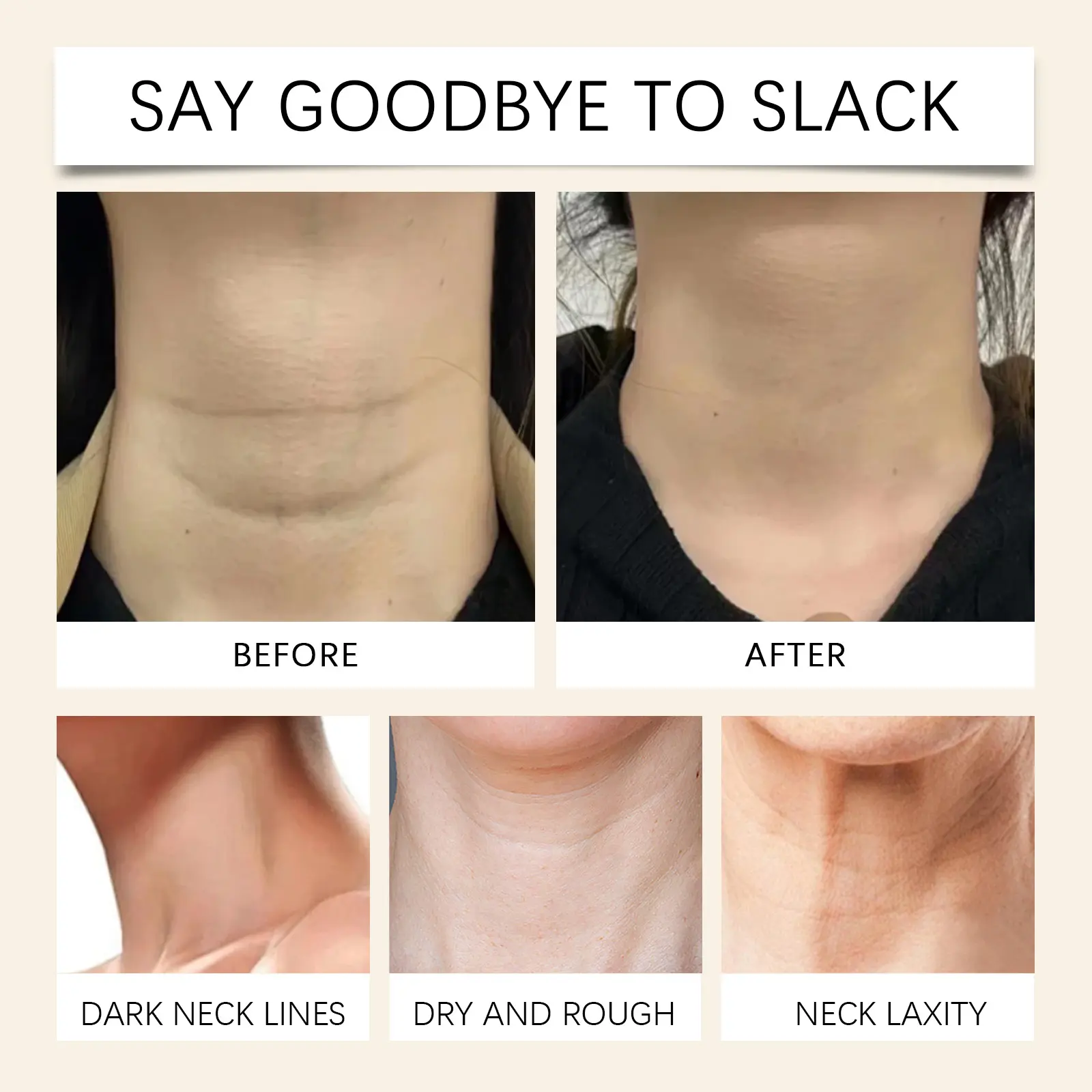 Neck Moisturizing Treatment Essence for Elastic Skin - West&Month 9 neck moisturizing essence nourish elastic skin West Month 491 7527