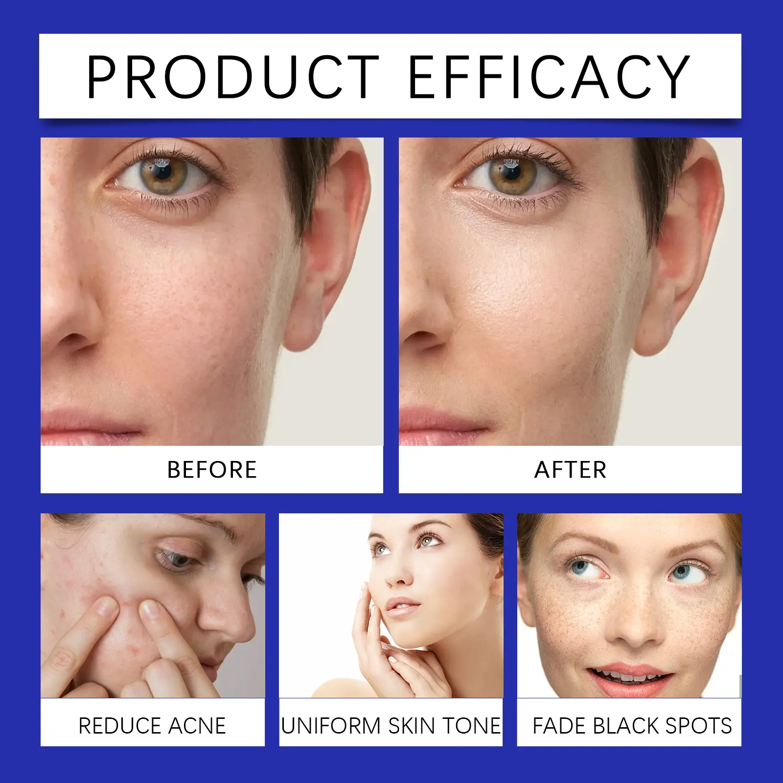 Niacinamide Essence Emulsion Hydrating & Brightening Moisturizer - West&Month 9 nicotinamide emulsion hydrate moisturize brighten West Month 547 8322
