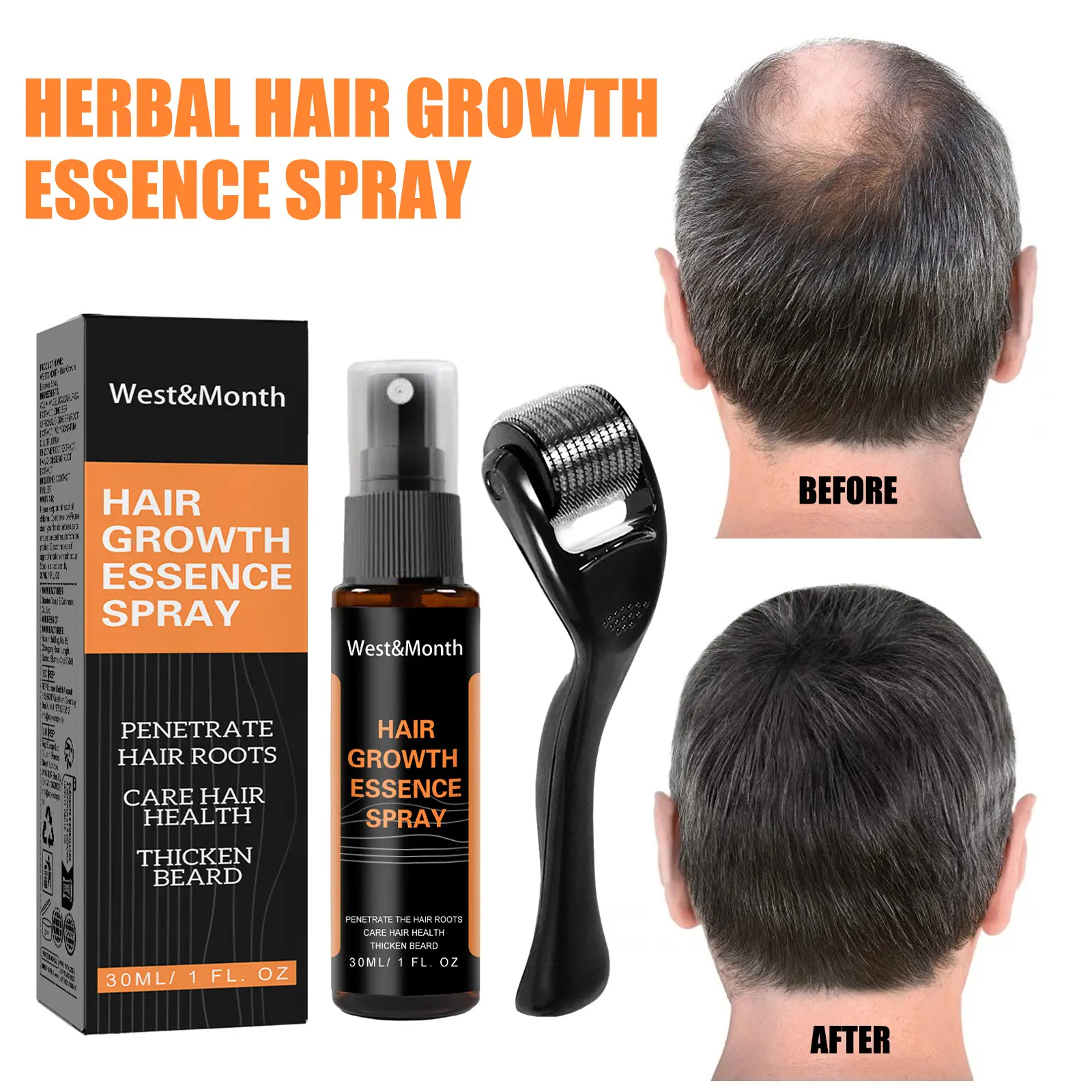 Hair Growth Spray for Thickening with Ginger & Fo-Ti - West&Month 2 polygonum multiflorum hair spray anti loss West Month 121 11397