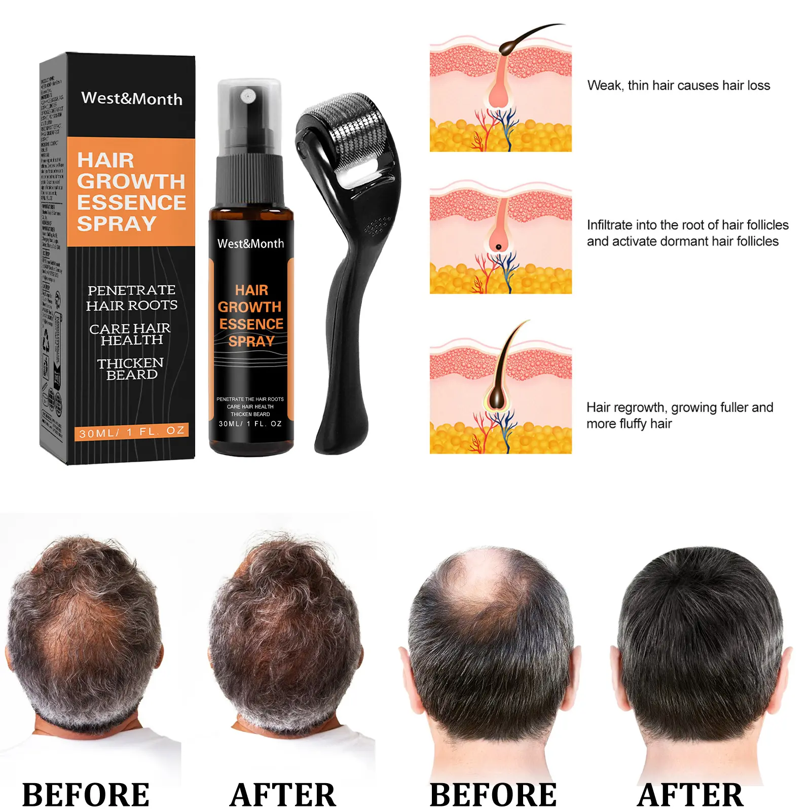 Hair Growth Spray for Thickening with Ginger & Fo-Ti - West&Month 5 polygonum multiflorum hair spray anti loss West Month 121 11400