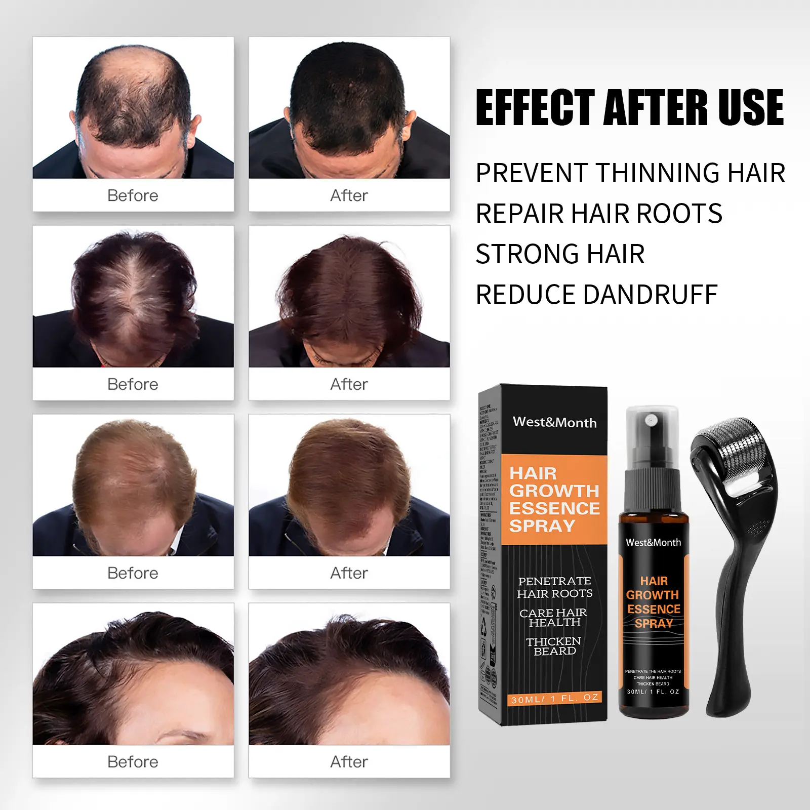 Hair Growth Spray for Thickening with Ginger & Fo-Ti - West&Month 6 polygonum multiflorum hair spray anti loss West Month 121 11401