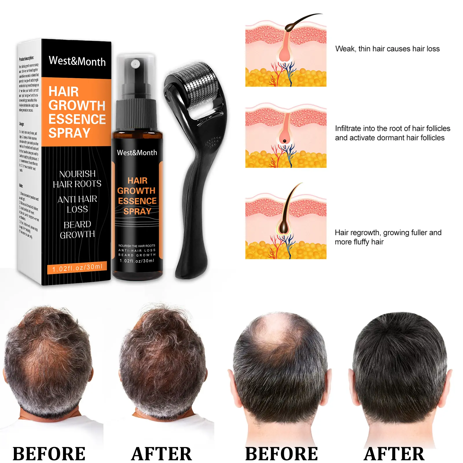 Polygonum Multiflorum Ginger Hair Spray for Thickening - West&Month 4 polygonum multiflorum hair spray anti loss West Month 320 5133
