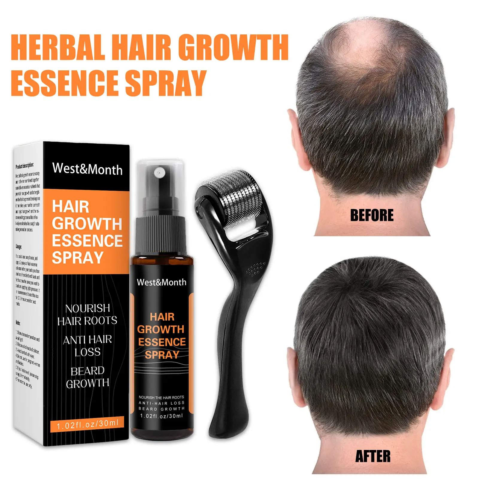 Polygonum Multiflorum Ginger Hair Spray for Thickening - West&Month 6 polygonum multiflorum hair spray anti loss West Month 320 5135