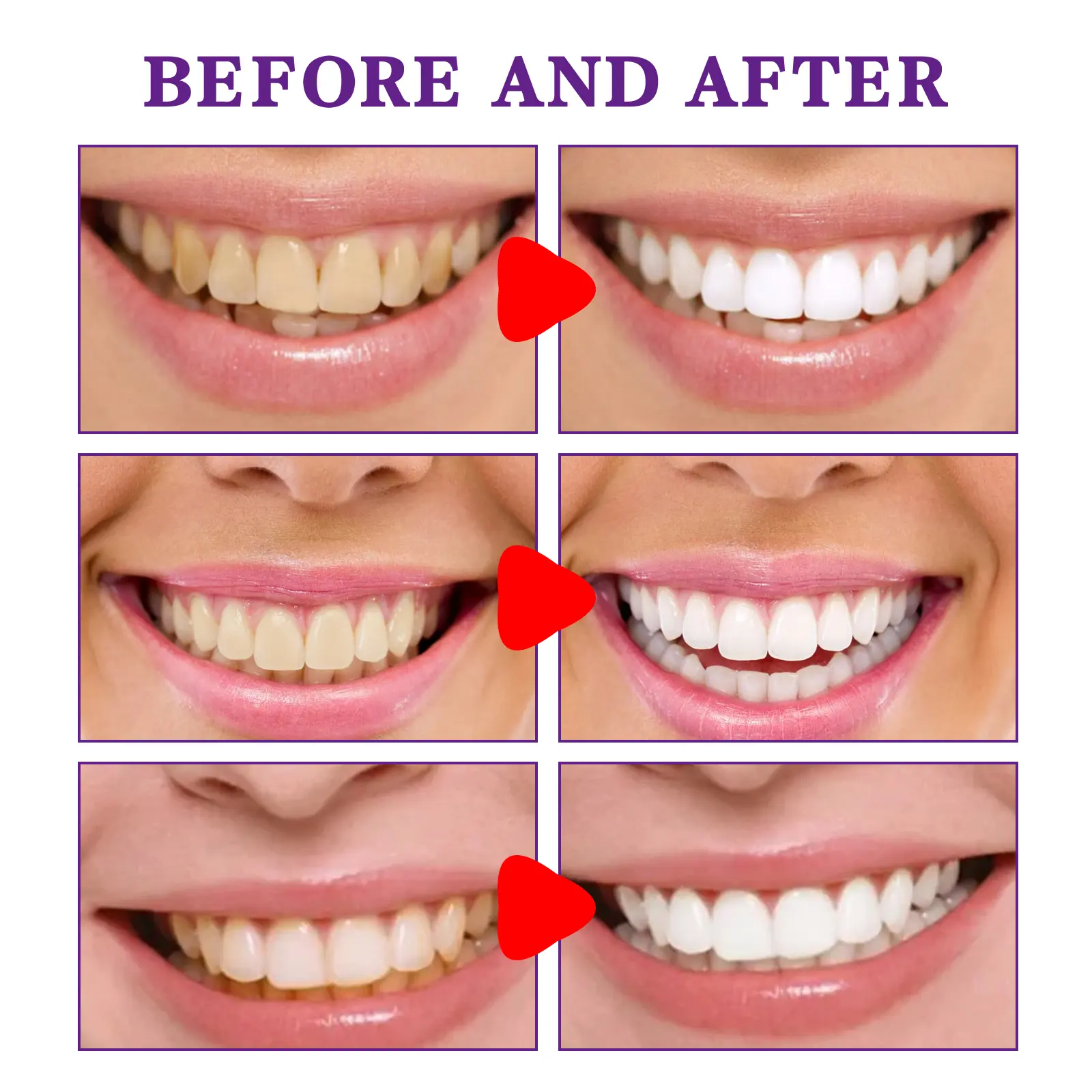Purple Mousse Toothpaste for Stain Removal & Fresh Breath - West&Month 7 purple mousse toothpaste daily clean stains freshen West Month 272 4524