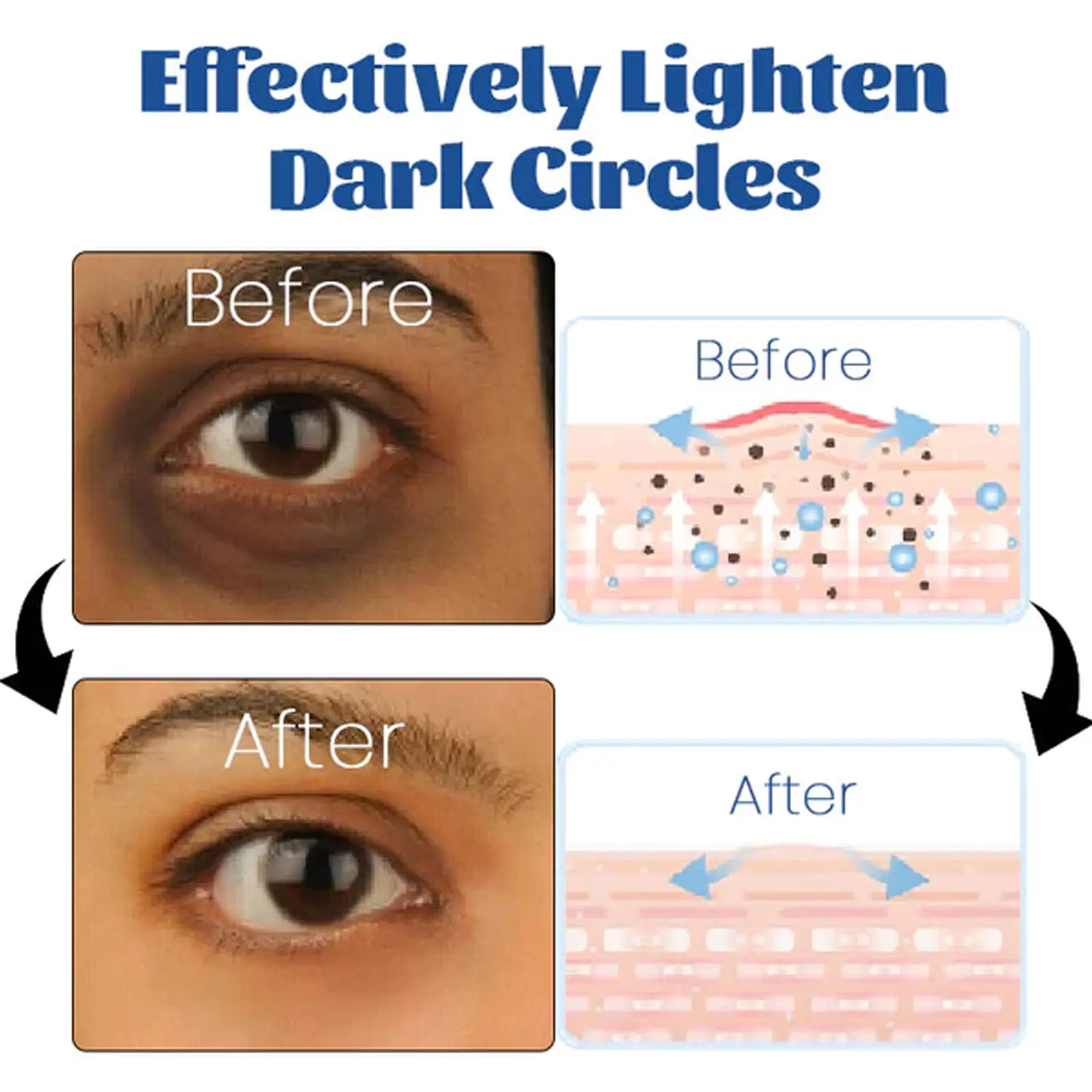 Retinol Eye Cream for Dark Circles & Firming - West&Month 8 retinol firming eye cream repair dark circles West Month 226 3951