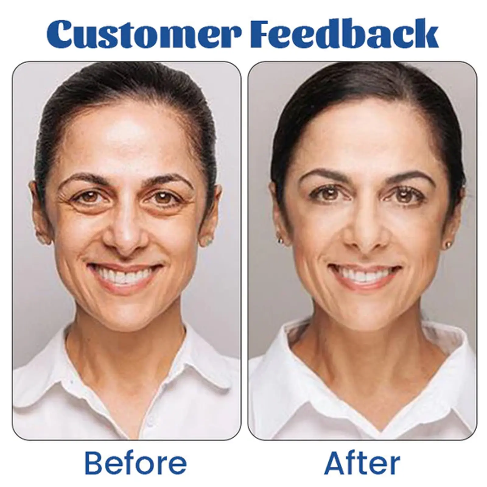 Retinol Eye Cream for Dark Circles & Firming - West&Month 10 retinol firming eye cream repair dark circles West Month 226 3953