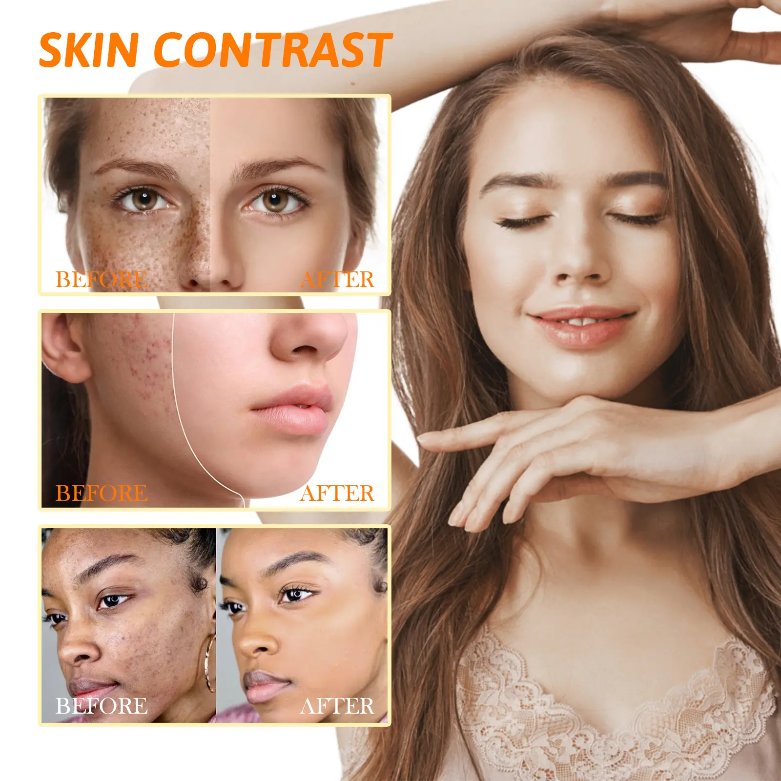 Retinol Pigment Correcting Spray for Dark Spot Brightening - West&Month 8 retinol spray lighten spots moisturize whiten West Month 329 5259