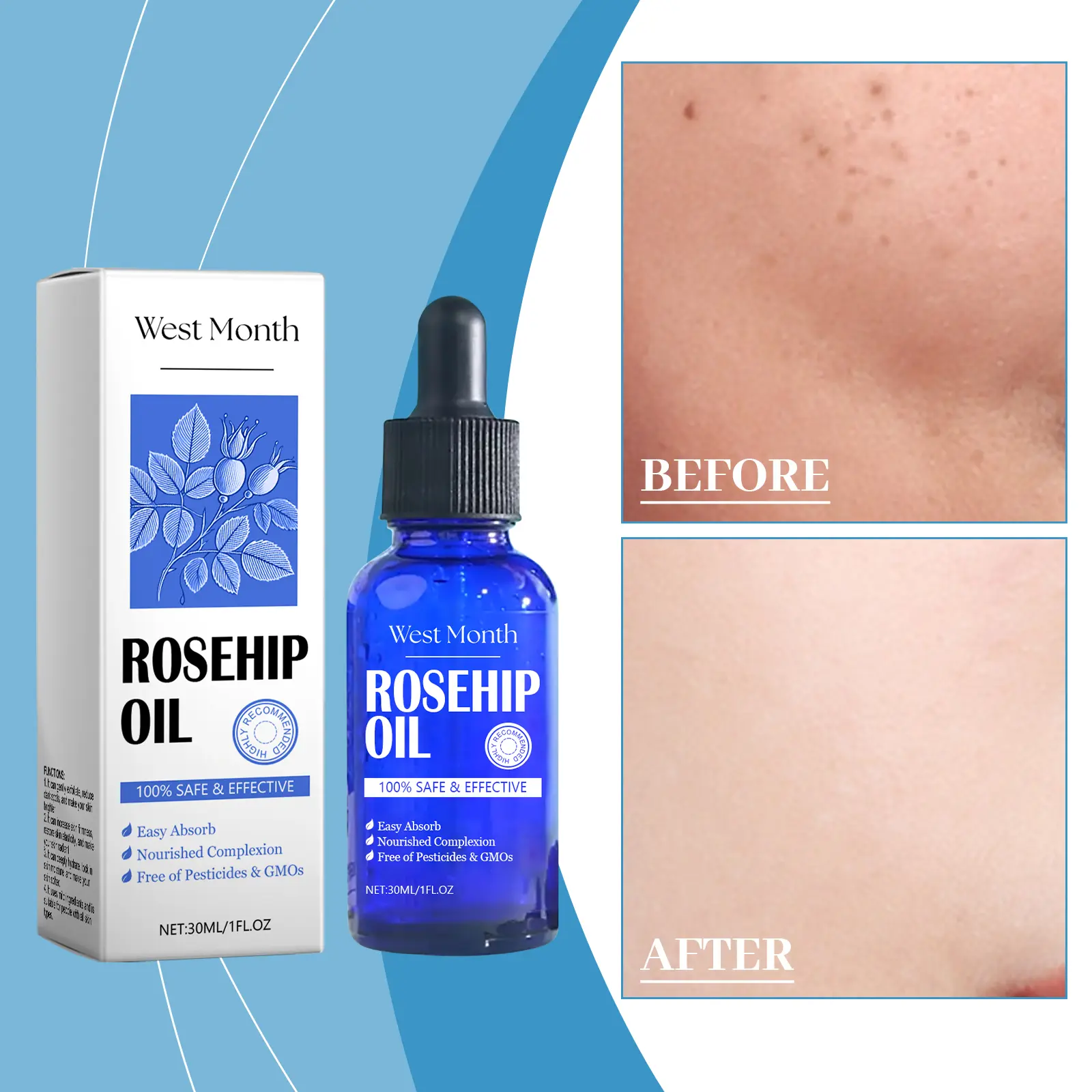 Rosehip Facial Oil for Moisturizing & Brightening - West&Month 2 rose hip oil facial moisturize firm tender West Month 526 8032