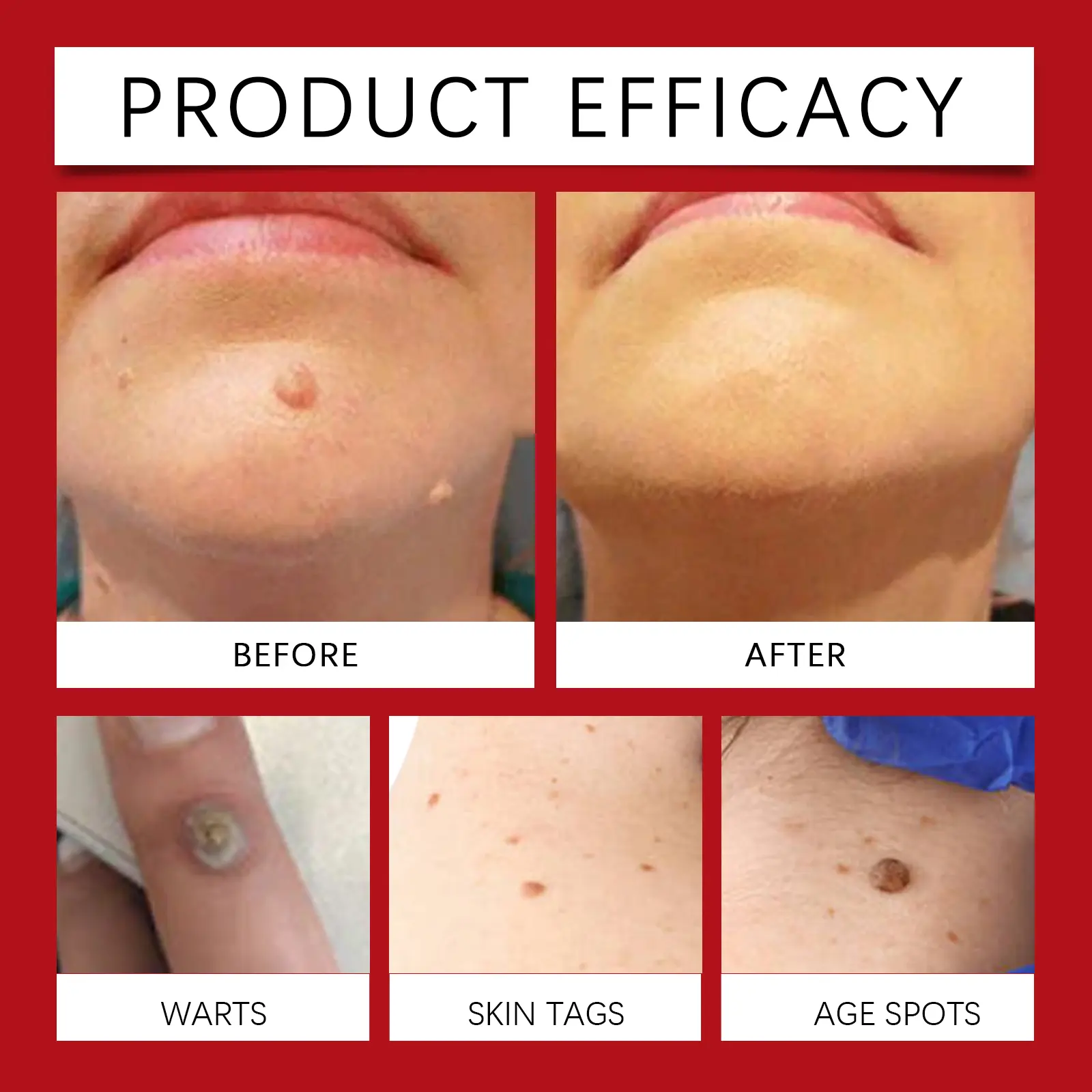 Rosehip Seed Oil for Smooth Skin & Deep Hydration - West&Month 9 rosehip seed wart essence oil moisturize West Month 048 1715