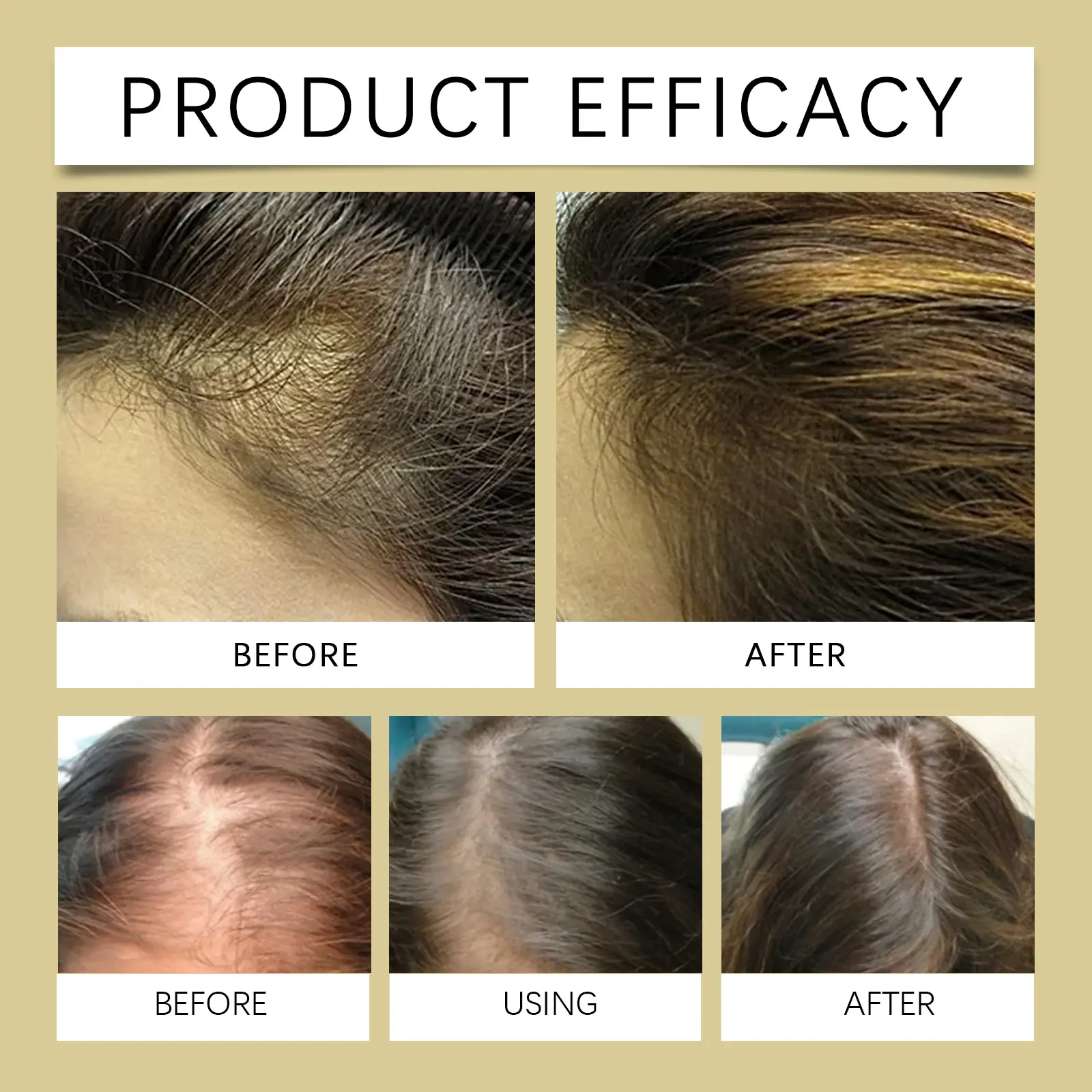 Rosemary Hair Oil Nourishing Essential Oil by West&Month 9 rosemary hair oil nourish gentle West Month 213 3787