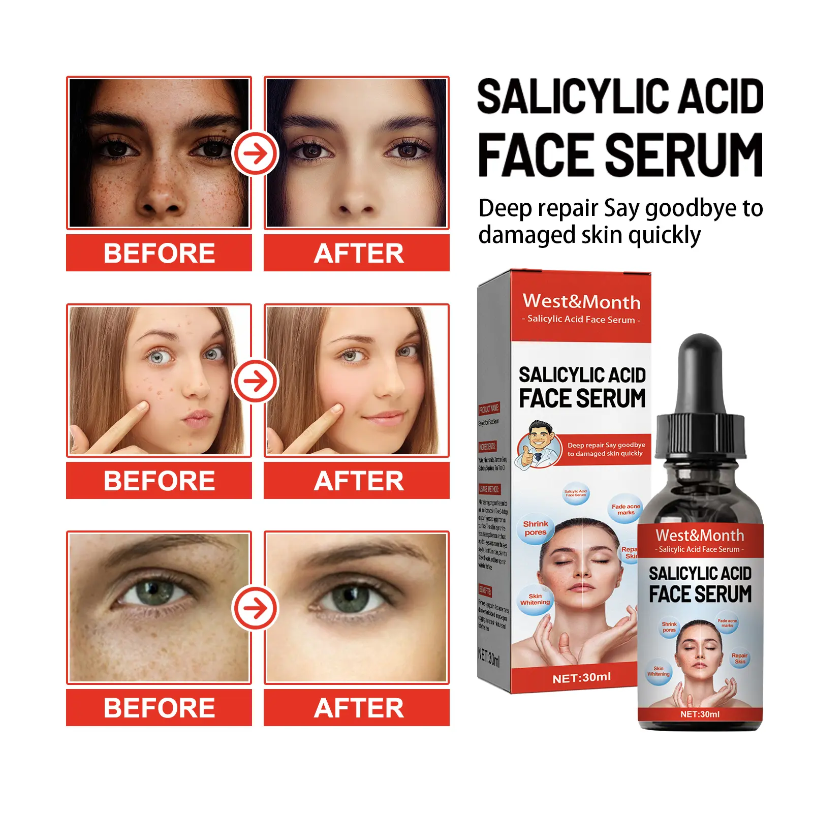 Salicylic Acid Essence Pore Cleansing & Repair - West&Month 7 salicylic acid essence hydrate repair improve West Month 422 6553