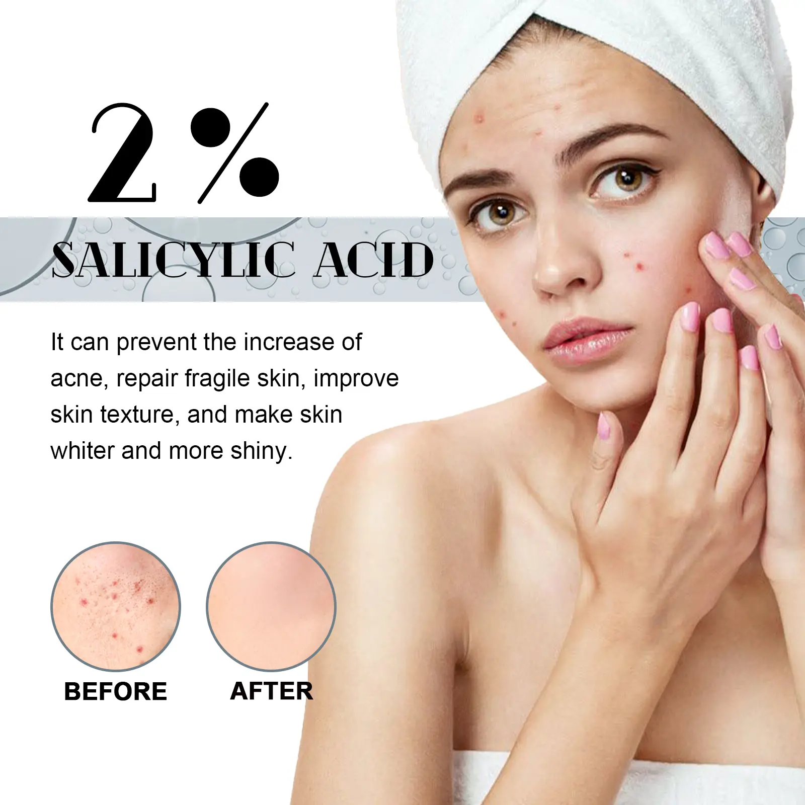 Salicylic Acid Facial Essence for Acne Marks & Hydration - West 6 salicylic acid essence lighten acne mark West Month 278 4606
