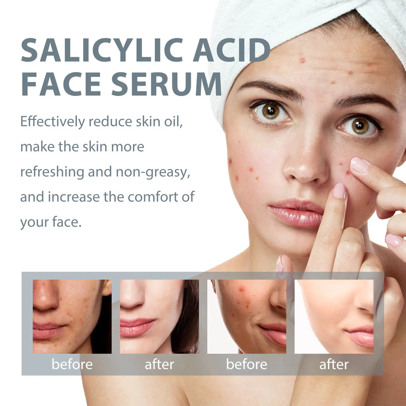 Salicylic Acid Facial Essence for Acne Marks & Hydration - West 7 salicylic acid essence lighten acne mark West Month 278 4607