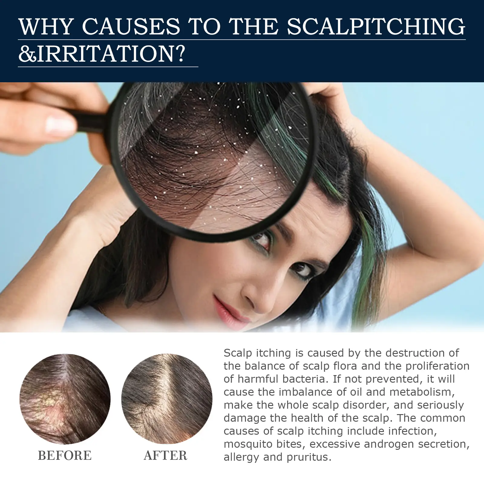 Scalp Treatment Essence Spray for Damaged Hair & Roots - West&Month 5 scalp treatment spray repair damaged follicle West Month 206 3683