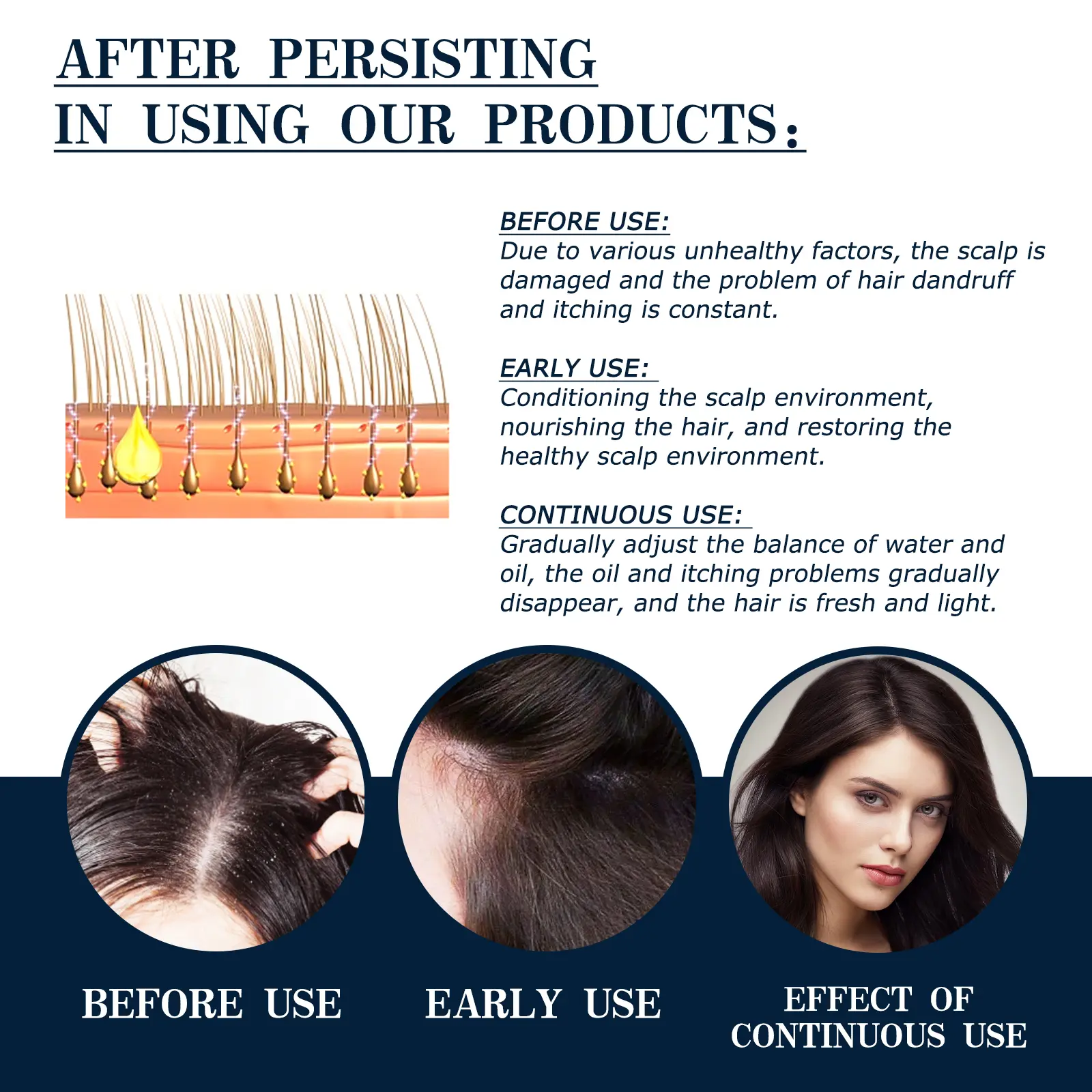Scalp Treatment Essence Spray for Damaged Hair & Roots - West&Month 6 scalp treatment spray repair damaged follicle West Month 206 3684