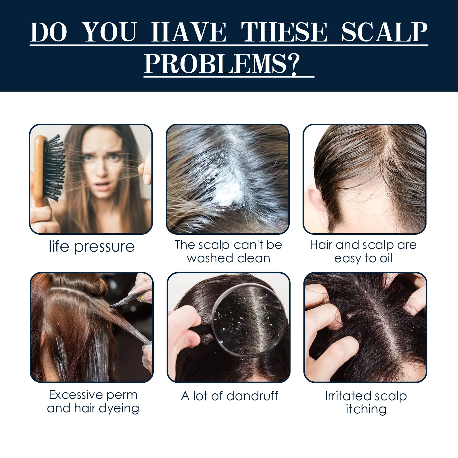 Scalp Treatment Essence Spray for Damaged Hair & Roots - West&Month 7 scalp treatment spray repair damaged follicle West Month 206 3685