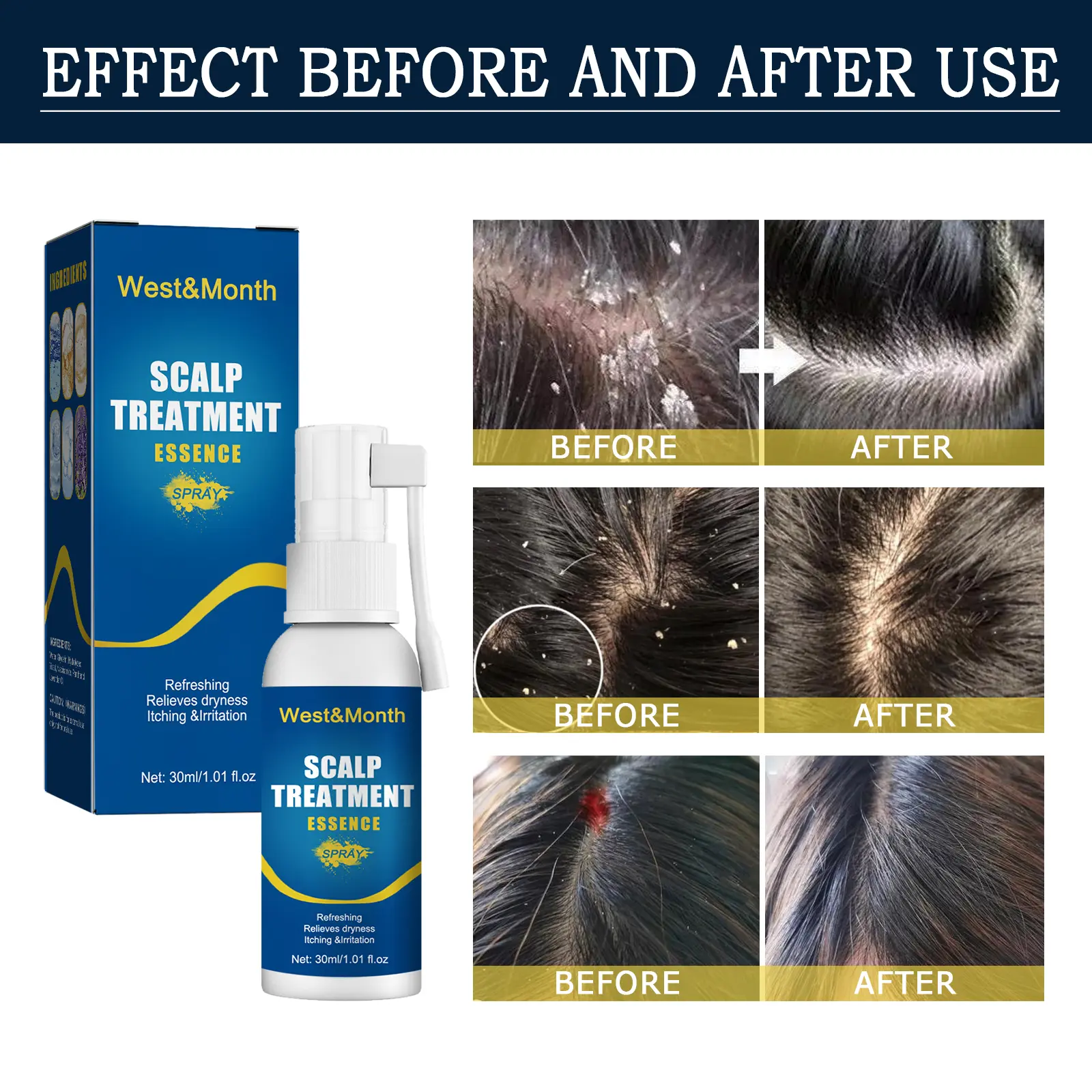 Scalp Treatment Essence Spray for Damaged Hair & Roots - West&Month 9 scalp treatment spray repair damaged follicle West Month 206 3686