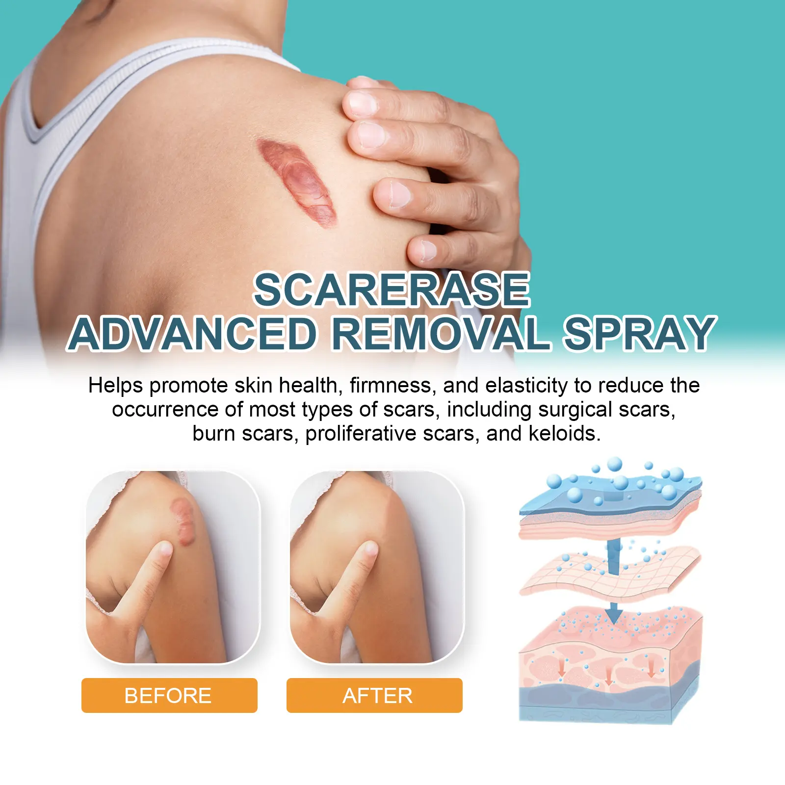 Scar Erase Spray for Fading Scars & Skin Repair - West&Month 5 scar erase spray fade moisturize repair West Month 126 2686