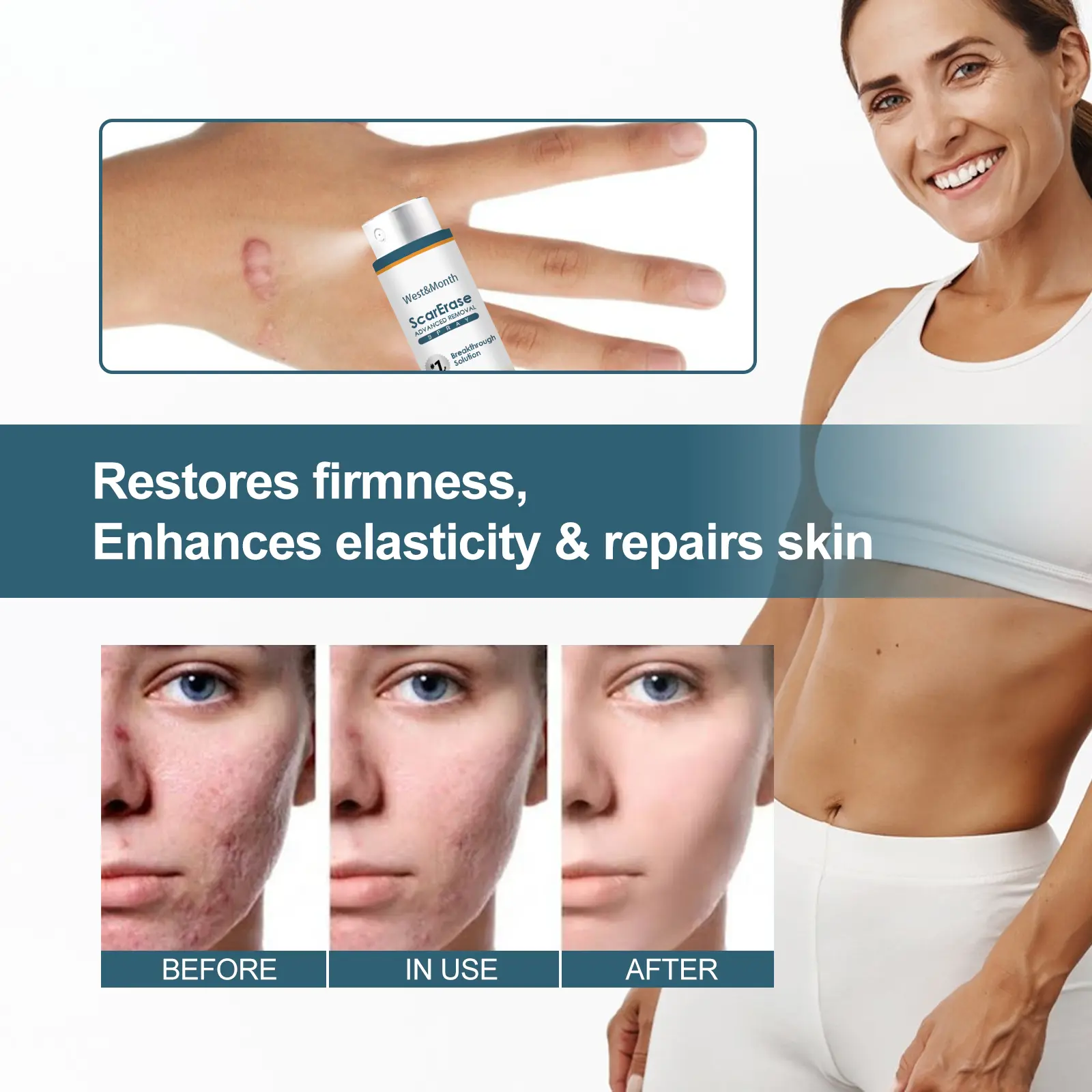 Scar Erase Spray for Fading Scars & Skin Repair - West&Month 7 scar erase spray fade moisturize repair West Month 126 2688