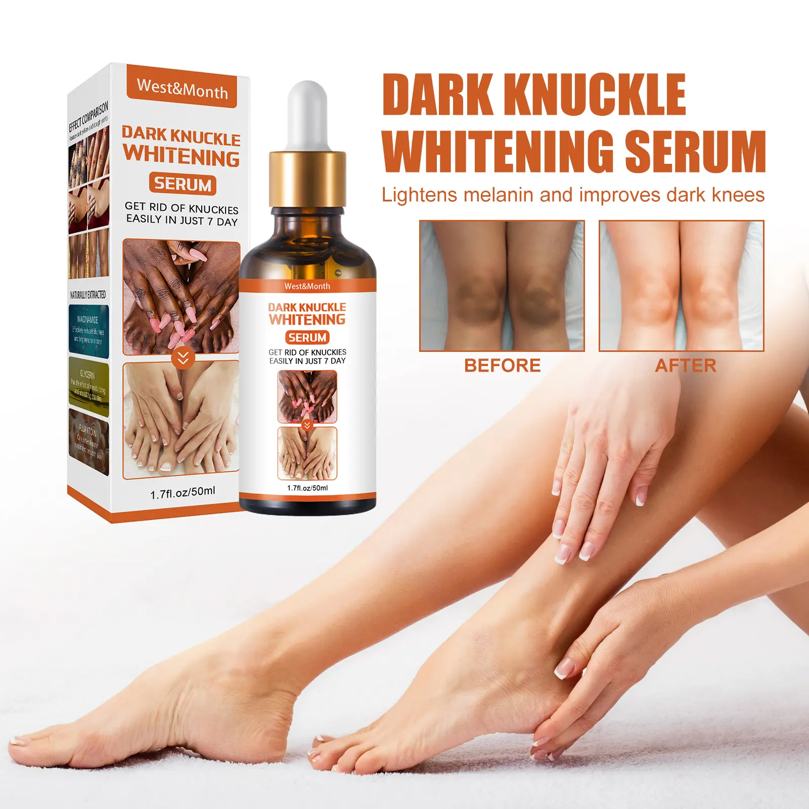 Skin Brightening Essence for Dark Spots on Knees & Elbows - West 2 skin blackening essence brightening remove melanin West Month 075 2034