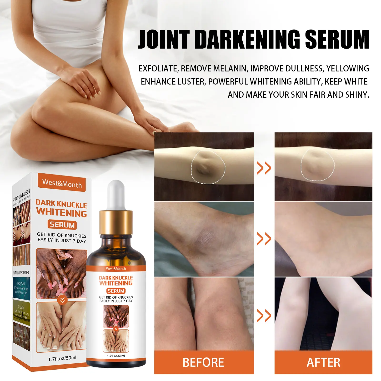 Skin Brightening Essence for Dark Spots on Knees & Elbows - West 5 skin blackening essence brightening remove melanin West Month 075 2036