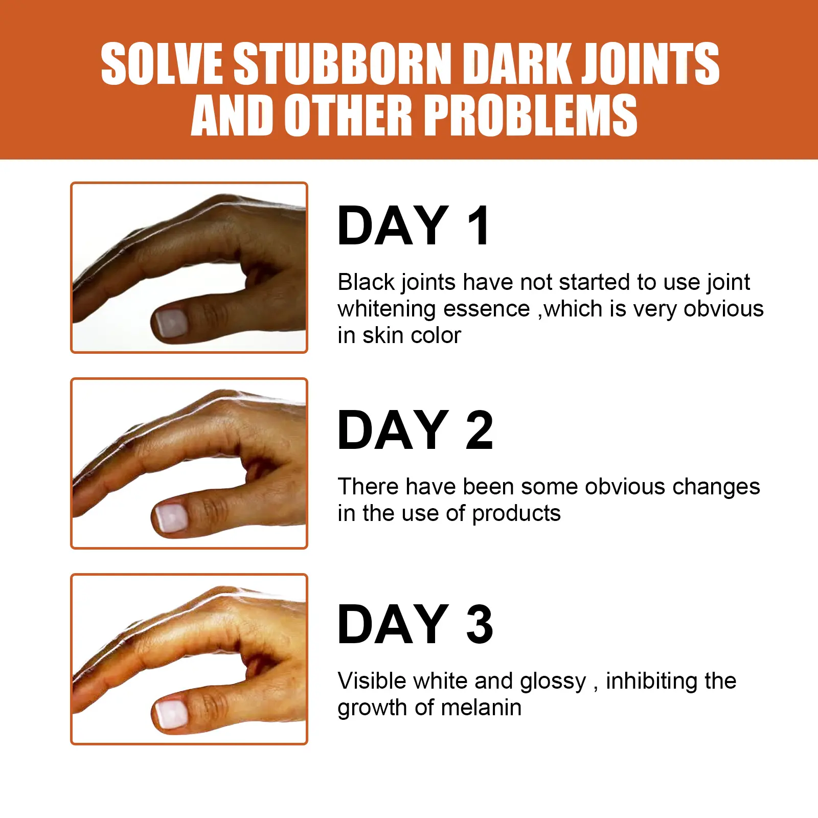Skin Brightening Essence for Dark Spots on Knees & Elbows - West 6 skin blackening essence brightening remove melanin West Month 075 2037