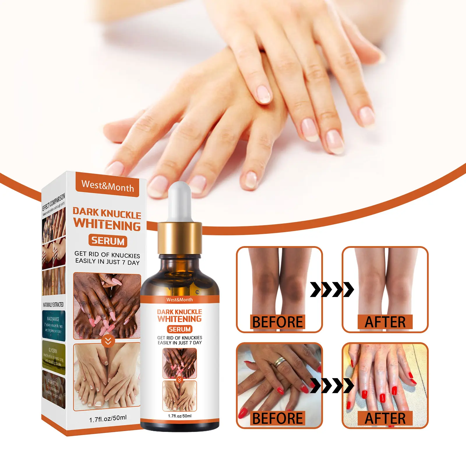 Skin Brightening Essence for Dark Spots on Knees & Elbows - West 7 skin blackening essence brightening remove melanin West Month 075 2038