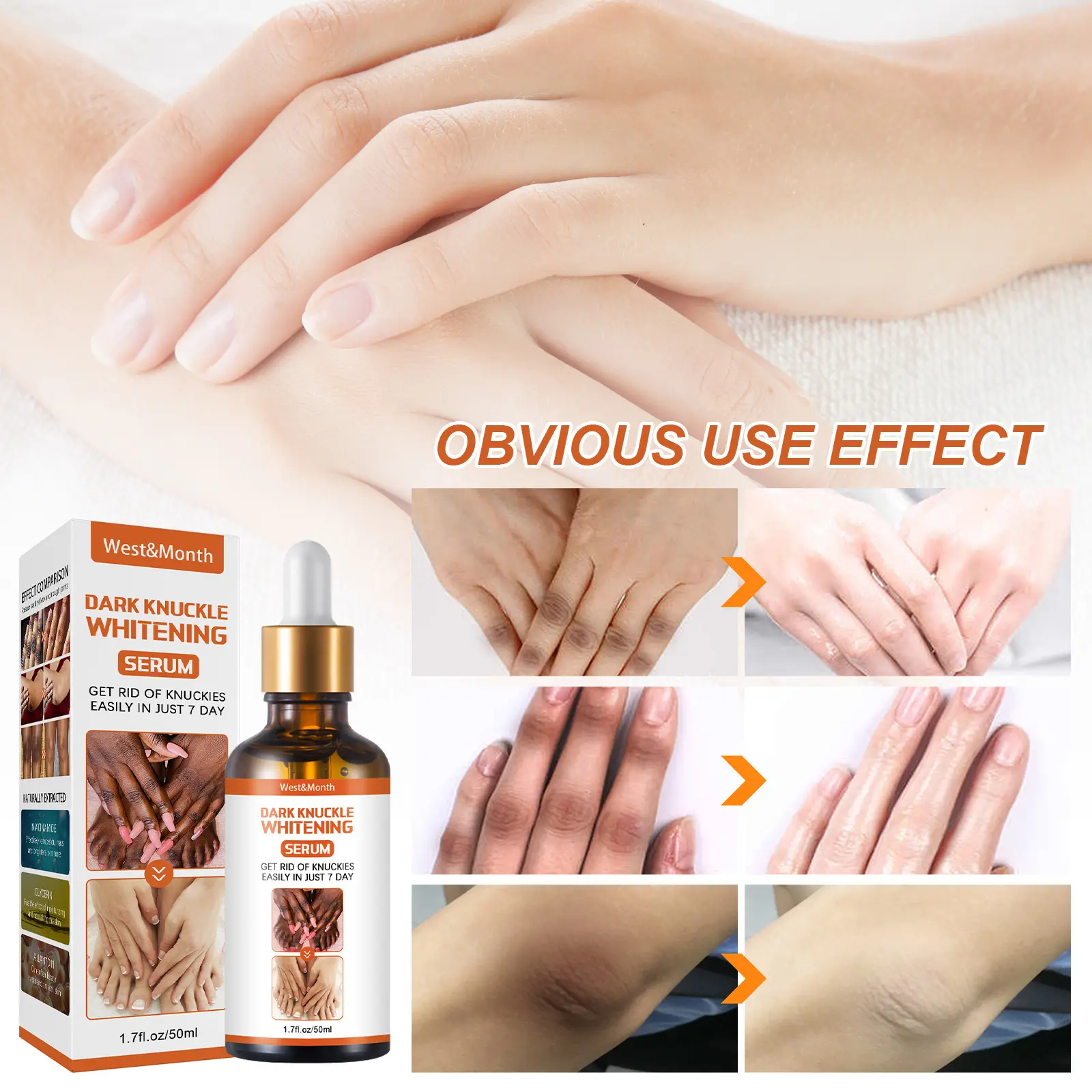 Skin Brightening Essence for Dark Spots on Knees & Elbows - West 8 skin blackening essence brightening remove melanin West Month 075 2039