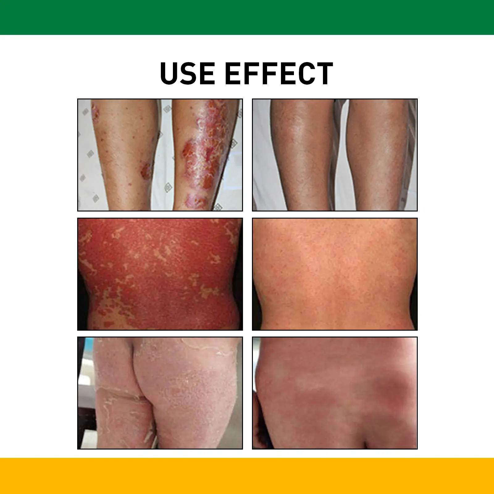 Skin Care Cream for Dry Skin Relief - West&Month 11 skin care cream gentle relief hands feet West Month 656 9448