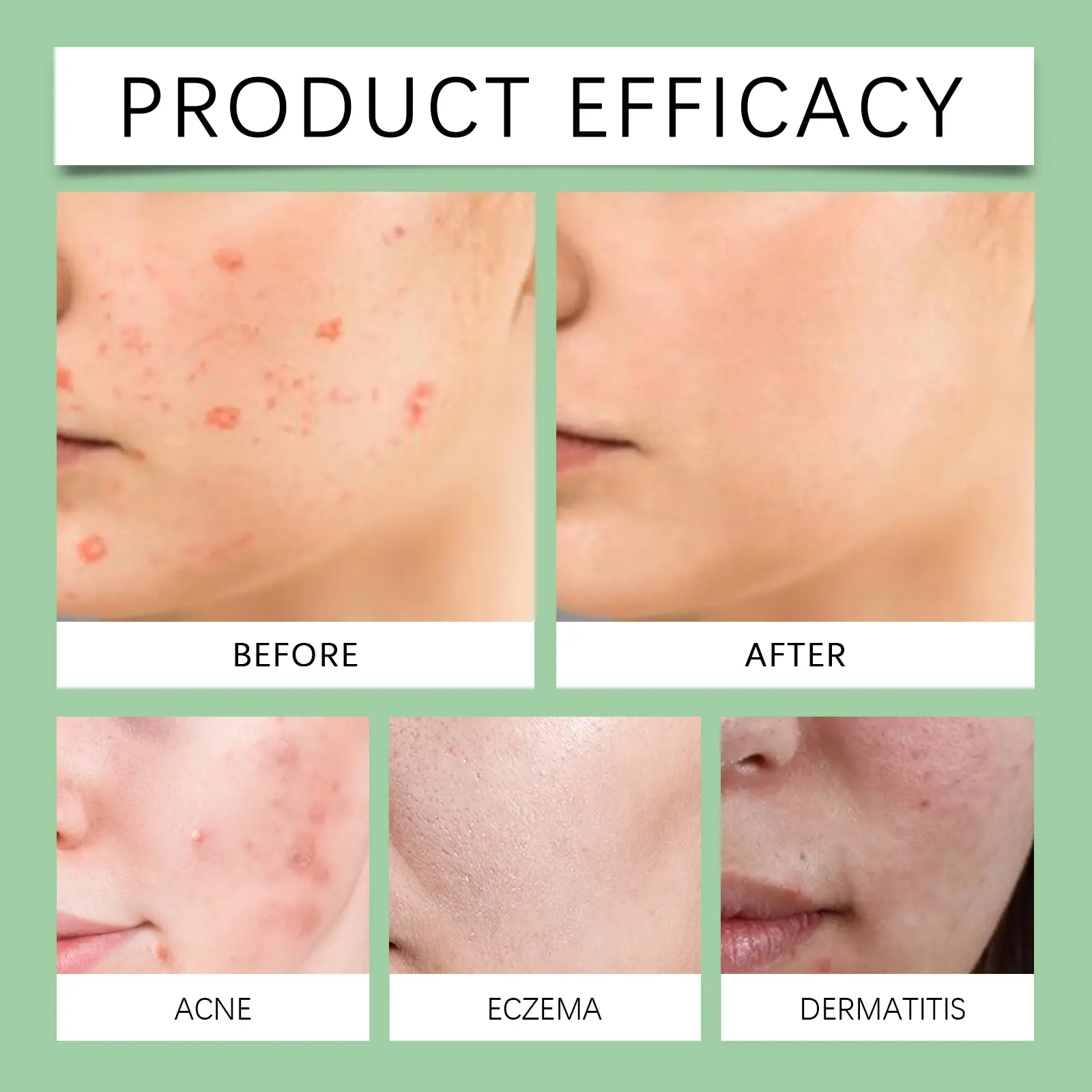 Essential Oil for Skin Moisturizing & Soothing Treatment | West&Month 9 skin care oil soothe improve alleviate dry West Month 539 8231