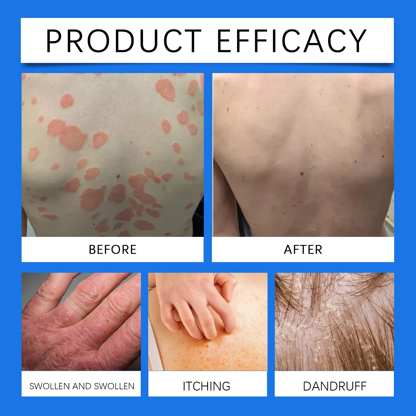 Moisturizing Cream with Vitamin D3 Nourishing Treatment West&Month 9 skin moisturizing cream gently nourish soothe West Month 532 8129